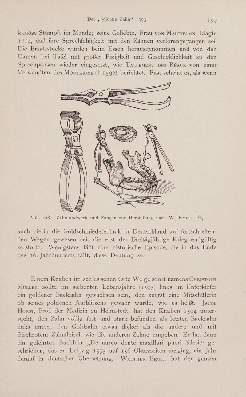 kariöse Stümpfe im Munde; seine Geliebte, Frau von Maintenon, klagte 1714, daß ihre Sprechfähigkeit mit den Zähnen verlorengegangen sei. Die Ersatzstücke wurden beim Essen herausgenommen und von den Damen bei Tafel mit großer Fixigkeit und Geschicklichkeit zu den Sprechpausen wieder eingesetzt, wie Tallement des Reaux von einer Verwandten des Montaigne (+ 1592) berichtet. Fast scheint es, als wenn Abb. 108. Zahnbindwerk und Zangen zur Herstellung nach W. Ryff. 2/3. auch hierin die Goldschmiedetechnik in Deutschland auf fortschreiten¬ den Wegen gewesen sei, die erst der Dreißigjährige Krieg endgültig zerstörte. Wenigstens läßt eine historische Episode, die in das Ende des 16. Jahrhunderts fällt, diese Deutung zu. Einem Knaben im schlesischen Orte Weigelsdort namens Christoph Müller sollte im siebenten Lebensjahre (1593) links im Unterkiefer ein goldener Backzahn gewachsen sein, den zuerst eine Mitschülerin ob seines goldenen Aufblitzens gewahr wurde, wie es heißt. Jacob Horst, Prof, der Medizin zu Helmstedt, hat den Knaben 1594 unter¬ sucht, den Zahn völlig fest und stark befunden als letzten Backzahn links unten, den Goldzahn etwas dicker als die andere und mit frischrotem Zahnfleisch wie die anderen Zähne umgeben. Er hat dann ein gelehrtes Büchlein „De aureo dente maxillari pueri Silesii“ ge¬ schrieben, das zu Leipzig 1595 auf 156 Oktavseiten ausging, ein Jahr darauf in deutscher Übersetzung. Walther Bruck hat der ganzen