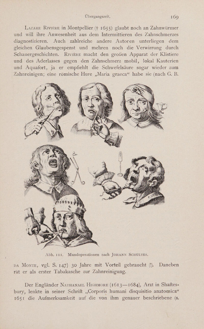 Lazare Riviere in Montpellier (f 1655) glaubt noch an Zahnwürmer und will ihre Anwesenheit aus dem Intermittieren des Zahnschmerzes diagnostizieren. Auch zahlreiche andere Autoren unterliegen dem gleichen Glaubensgespenst und mehren noch die Verwirrung durch Schauergeschichten. Riviere macht den großen Apparat der Klistiere und des Aderlasses gegen den Zahnschmerz mobil, lokal Kauterien und Aquafort, ja er empfiehlt die Schwefelsäure sogar wieder zum Zahnreinigen; eine römische Hure „Maria graeca“ habe sie (nach G. B. Abb. m. Mundoperationen nach Johann Schultes. da Monte, vgl. S. 147) 30 Jahre mit Vorteil gebraucht (!). Daneben rät er als erster Tabakasche zur Zahnreinigung. Der Engländer Nathanael Highmore (1613—1684), Arzt in Shaftes- bury, lenkte in seiner Schrift „Corporis humani disquisitio anatomica“ 1651 die Aufmerksamkeit auf die von ihm genauer beschriebene (s.