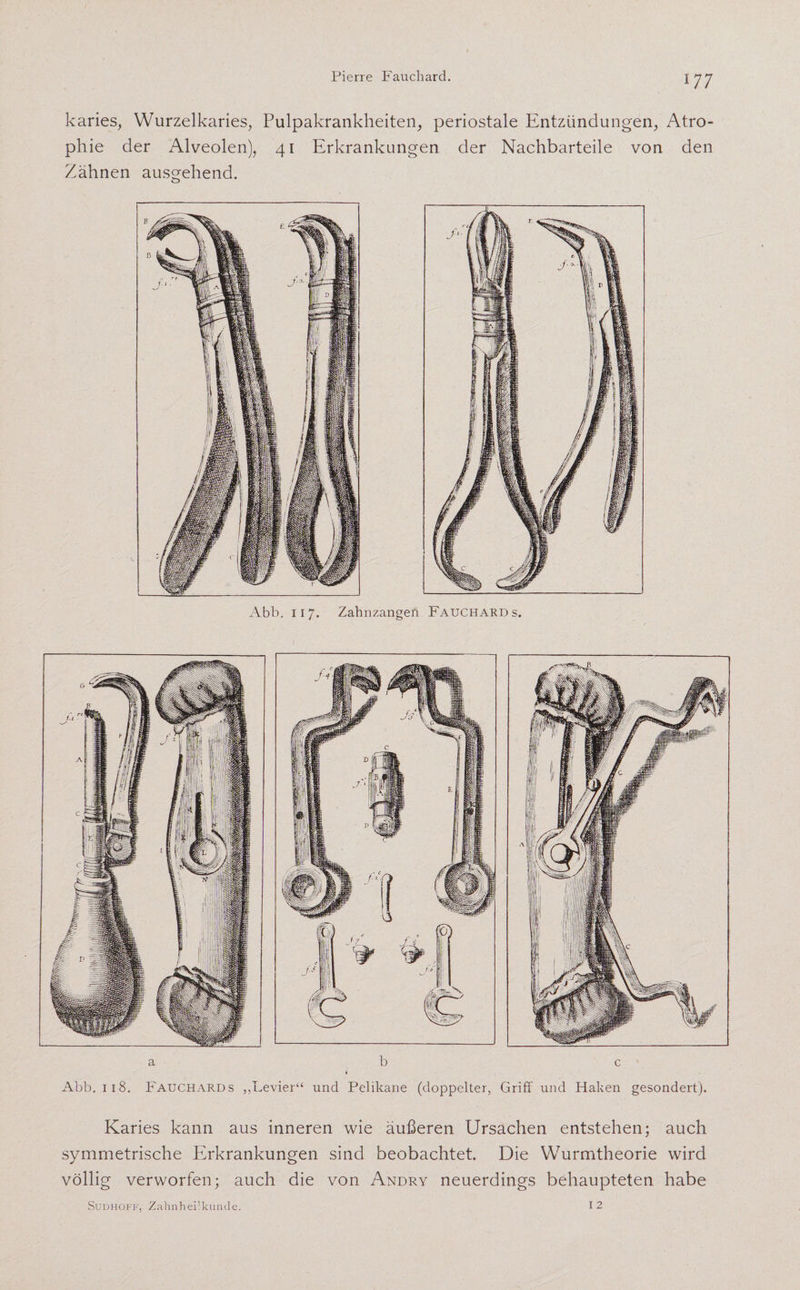 karies, Wurzelkaries, Pulpakrankheiten, periostale Entzündungen, Atro¬ phie der Alveolen), 41 Erkrankungen der Nachbarteile von den Zähnen ausgehend. o Abb. 117. Zahnzangen Fauchard s. a b c Abb. 118. Fauchards „Levier“ und Pelikane (doppelter, Griff und Haken gesondert). Karies kann aus inneren wie äußeren Ursachen entstehen; auch symmetrische Erkrankungen sind beobachtet. Die Wurmtheorie wird völlig verworfen; auch die von Andry neuerdings behaupteten habe Sudhoff, Zabnheilkunde. 12