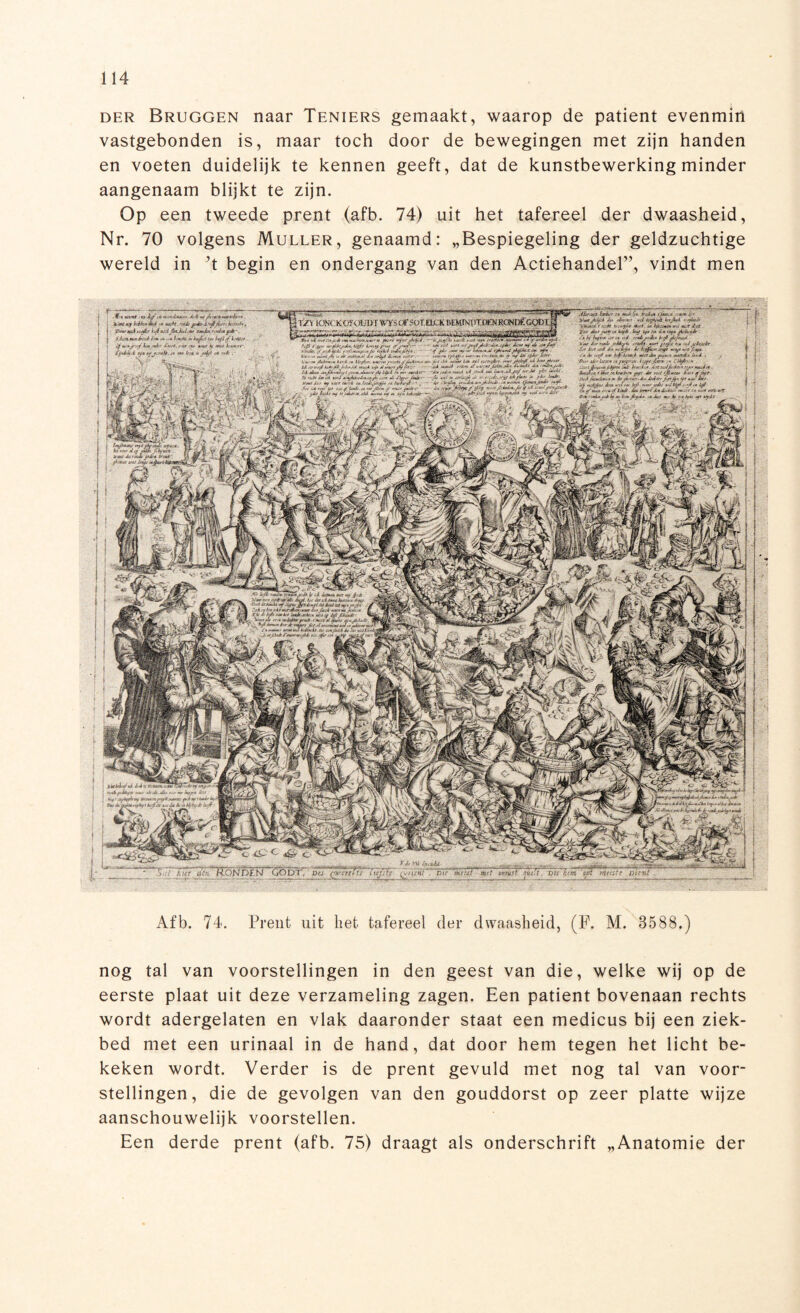 der Bruggen naar Teniers gemaakt, waarop de patiënt evenmin vastgebonden is, maar toch door de bewegingen met zijn handen en voeten duidelijk te kennen geeft, dat de kunstbewerking minder aangenaam blijkt te zijn. Op een tweede prent (afb. 74) uit het tafereel der dwaasheid, Nr. 70 volgens Muller, genaamd: „Bespiegeling der geldzuchtige wereld in ’t begin en ondergang van den Actiehandel”, vindt men Aléfafat Ixrkit ;• meJeftx. fadex >fuo.:n usu» l;r tyaxtJkUA Je* éZfaftt vei utfu*è letjkd aejktJi a'tatee. f r.At u.faL» xuet e* bauwt vd uwe Zit l'zv Zat fat» v fafé W XfX fex Lx <a*t AiherJt ex b ffaP» <;é </, ui réx&juZe* hfttftiftiUtJ- >tw Zee rauL fiiA/f U eAtrit vtrt gtft-x tex e*J fahjxclet ■ £/r fat -fat fa fa'Zffa • fa fag* fatyt vrije*/* fa fa esrft vu ift'Z-Mt-i xcttJxa fav/wi HufxZa fait <■ , ■ béfaftftx ex fftftre* , ZeortJfcMt-sxjtiifm i£é ift* faain, '&*&** t ifae .-x fateJffif ftff.fa fati (J&fatof .frfa f'fat- •iXfiJjiéiuJpevx Ir, Ztftrr-xet/Jaa. Zetip' jftfjft tft xfa rXf fa nfaftis fa» vei'ie tik tmé éi fa fa ityf éi t/fi* tft Ze, faseujt faitift tixJt■ fat «rarefa fa fase nteiss ;u au* e&lexfa Det, rfaüisfa i* ut. in*. ftf-At. ex fa/ xee fa eest fax* aft *fdt ■ 'f t hm fat i f> txe.-eZxi.zs, Z& af fterx'a tautefarr . fa fa fa kfk*-£nfa xaAts mfie pfafattf-'jtutx faxfa*, ixfabr ift xéfaj&téf&té*? imfa# ruefat , SJéfaXUA fafé ée% ,«hut*.«ieftef u* iefl ,f l.-fiff 0 /téfafakfaïfake Zfaet, fxr ex* waar k «fa* kuixrf. l'ixfafa.Z fftgiW&ï et M* kéét te jftft ex rxfa,- puri faacjfak J., ~~L, ffaéfa x-ereit —êfaafafa fat« fa éi* ■ teer ïstoreuxt *'jfa*fa ftgèfuct x* atfa . s, 'vjere** (tufaxfat Xe fa fa'fafa. Lire ■M aaxaé kfa fvLtfafrifaé. ftrZep Ui fatjfafa. aasèJ Sefa-tx ét véfifaifafafafa Ziixckt fa 'pfafUjeit aZxnzeet uZ faui es*, lfafa.nl Jttf u* Z# fke Ueaif eil tf éftkfft J, ex ceéZ.et# tèifiut/ ia. jffa faifa. 'ieftfa cru fatéré/jffafa- ix uamx tfauxjfafa fvft. fttkfa **étjfafak*.& Jf*4 faKtijfax#* u„.é. fafajreei «y»ft fareofa-J fa oei vet Zee k*t/e*. J&eiteu» tarei ex ifagkes, ooeeeafufaéufjtaA*** td faifaf ifa jk Zlbfa. fafa fa, ei kveegbJtteé' Zei ZZet txjskéxiefe géxsx.okdzrt éif litfeh fa vé> mtrJïtt~ X> *efa fa Ui mZ 4ixfaZ.fL.a,é^e. nee fa Zifau fafa-. - Voxtfar fa vzet iaevi ex faJejJrafax eè. Lv&crijt f ■■* -■■■ -<é< ‘H rtxs fa faeff'lvfa. ex eeéjlfat // «fUe ftfaor ■}Z* èfa.i xtf „ /ofaex.fai *ee*a fa est u-x tsJeaZt- 3>W« ■bfaiti fat jZrfa «wiaw *J\aufam « ‘ ieénxis a* u»,üfiti Ze eu> vuif p5 **b‘^ t^K4- y faffafafi ■■ -f ,,rKxaféfai-.U A.U.! ie rttJx fa MaxisiZbt tfaafala lf» ttiu Jvxix &**■* bfae.itfa t tfa. uaSegefasps xau> fafafaéte au fa étu.*>x Lu b' tfafafae fa Ortx*est/rfat'vuns, faixe ,iefae fat ifa Juuéfa&ifafas fakfii voZi Ze fa kf'ïifZ keft; 'Ronden cïobr. ■nmï 7 Dir m?ui met w4 mlïft Die hm tpf i/fteTi f Dient t Afb. 74. Prent uit bet tafereel der dwaasheid, (F. M. 3588.) nog tal van voorstellingen in den geest van die, welke wij op de eerste plaat uit deze verzameling zagen. Een patiënt bovenaan rechts wordt adergelaten en vlak daaronder staat een medicus bij een ziek¬ bed met een urinaal in de hand, dat door hem tegen het licht be¬ keken wordt. Verder is de prent gevuld met nog tal van voor¬ stellingen, die de gevolgen van den gouddorst op zeer platte wijze aanschouwelijk voorstellen. Een derde prent (afb. 75) draagt als onderschrift „Anatomie der