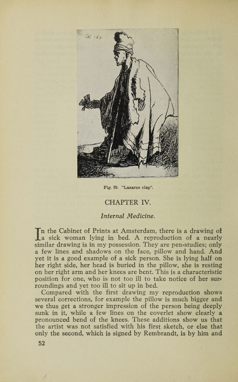 Fig. 29. Lazarus clap”. CHAPTER IV. Internal Medicine. In the Cabinet of Prints at Amsterdam, there is a drawing of a sick woman lying in bed. A reproduction of a nearly similar drawing is in my possession. They are pemstudies; only a few lines and shadows on the face, pillow and hand. And yet it is a good example of a sick person. She is lying half on her right side, her head is buried in the pillow, she is resting on her right arm and her knees are bent. This is a characteristic position for one, who is not too ill to take notice of her sur* roundings and yet too ill to sit up in bed. Compared with the first drawing my reproduction shows several corrections, for example the pillow is much bigger and we thus get a stronger impression of the person being deeply sunk in it, while a few lines on the coverlet show clearly a pronounced bend of the knees. These additions show us that the artist was not satisfied with his first sketch, or else that only the second, which is signed by Rembrandt, is by him and