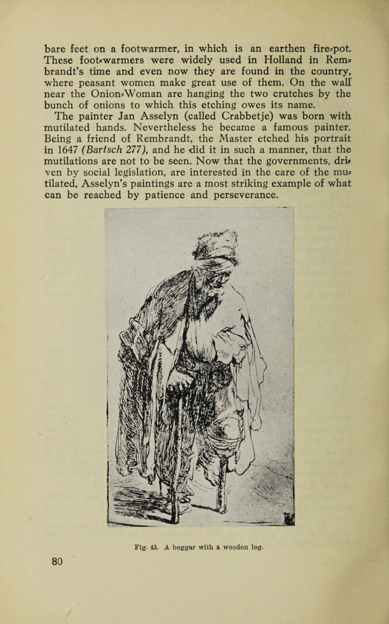These foot*warmers were widely used in Holland in Rem* brandt’s time and even now they are found in the country, where peasant women make great use of them. On the wall' near the Onion*Woman are hanging the two crutches by the bunch of onions to which this etching owes its name. The painter Jan Asselyn (called Crabbetje) was born with mutilated hands. Nevertheless he became a famous painter. Being a friend of Rembrandt, the Master etched his portrait in 1647 (Bartsch 277), and he did it in such a manner, that the mutilations are not to be seen. Now that the governments, dri* ven by social legislation, are interested in the care of the mu* tilated, Asselyn’s paintings are a most striking example of what can be reached by patience and perseverance. 80 Fig. 43. A beggar with a wooden leg.