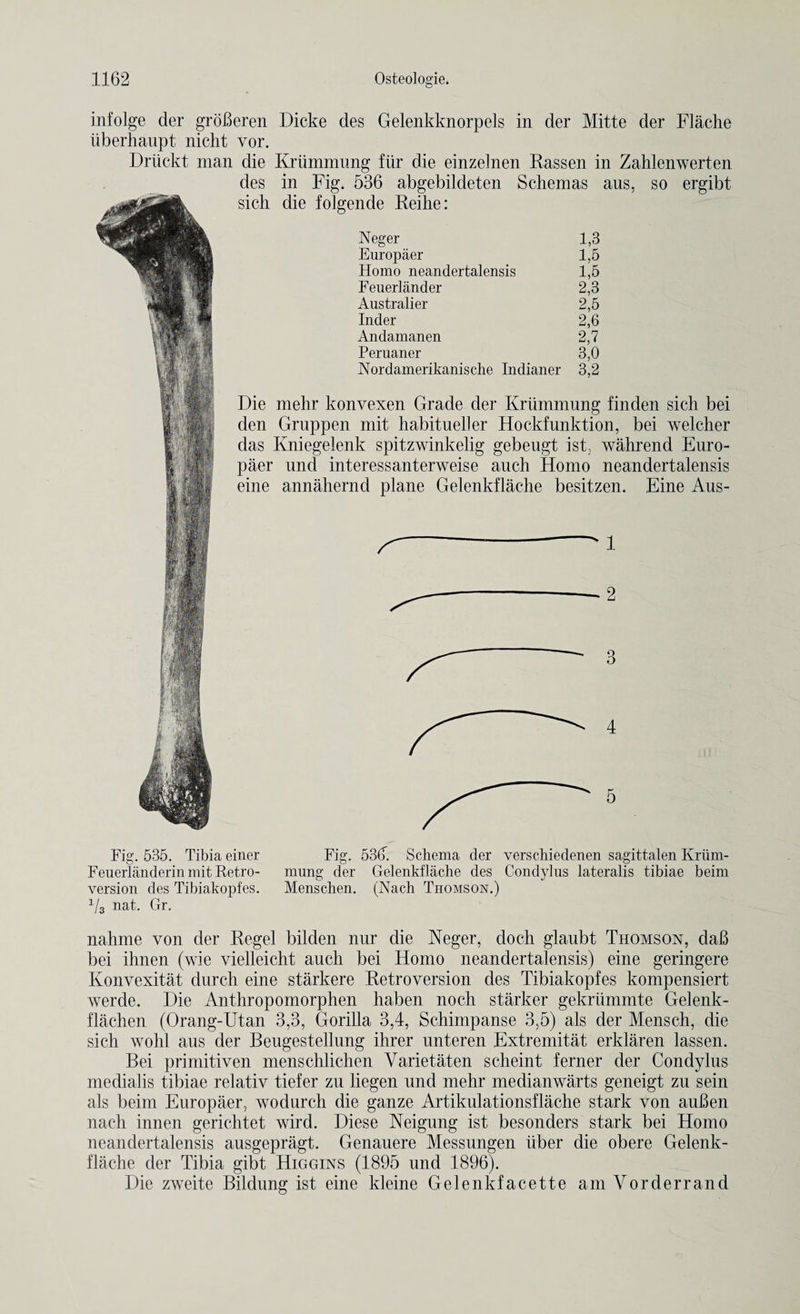infolge der grdBeren Dicke des Gelenkknorpels in der Mitte der Flache iiberhaupt nicht vor. Driickt man die Kriimmung fur die einzelnen Rassen in Zahlenwerten des in Fig. 536 abgebildeten Schemas aus, so ergibt sich die folgende Reihe: Neger 1,3 Europaer 1,5 Homo neandertalensis 1,5 Feuerlander 2,3 Australier 2,5 Inder 2,6 Andamanen 2,7 Peruaner 3,0 Nordamerikanische Indianer 3,2 Die mehr konvexen Grade der Kriimmung finden sich bei den Gruppen mit habitueller Hockfunktion, bei welcher das Ivniegelenk spitzwinkelig gebeugt ist, wahrend Euro¬ paer und interessanterweise auch Homo neandertalensis eine annahernd plane Gelenkflache besitzen. Fine Aus- 1 fq Fig. 535. Tibia einer Fenerlanderin mit Retro¬ version des Tibiakopfes. 1/3 nat. Gr. Fig. 53d. Schema der verschiedenen sagittalen Kriim- mung der Gelenkflache des Condylus lateralis tibiae beim Menschen. (Nach Thomson.) nahme von der Regel bilden nur die Neger, dock glaubt Thomson, dab bei ihnen (wie vielleicht auch bei Homo neandertalensis) eine geringere Konvexitat durch eine starkere Retroversion des Tibiakopfes kompensiert werde. Die Anthropomorphen haben noch starker gekriimmte Gelenk- flachen (Orang-Utan 3,3, Gorilla 3,4, Schimpanse 3,5) als der Mensch, die sich wohl aus der Beugestellung ihrer unteren Extremitat erklaren lassen. Bei primitiven menschlichen Yarietaten scheint ferner der Condylus medialis tibiae relativ tiefer zu liegen und mehr medianwarts geneigt zu sein als beim Europaer, wodurch die ganze Artikulationsflache stark von aufien nach innen gerichtet wird. Diese Neigung ist besonders stark bei Homo neandertalensis ausgepragt. Genauere Messungen iiber die obere Gelenk¬ flache der Tibia gibt Higgins (1895 und 1896). Die zweite Bildung ist eine kleine Gelenkfacette am Yorderrand