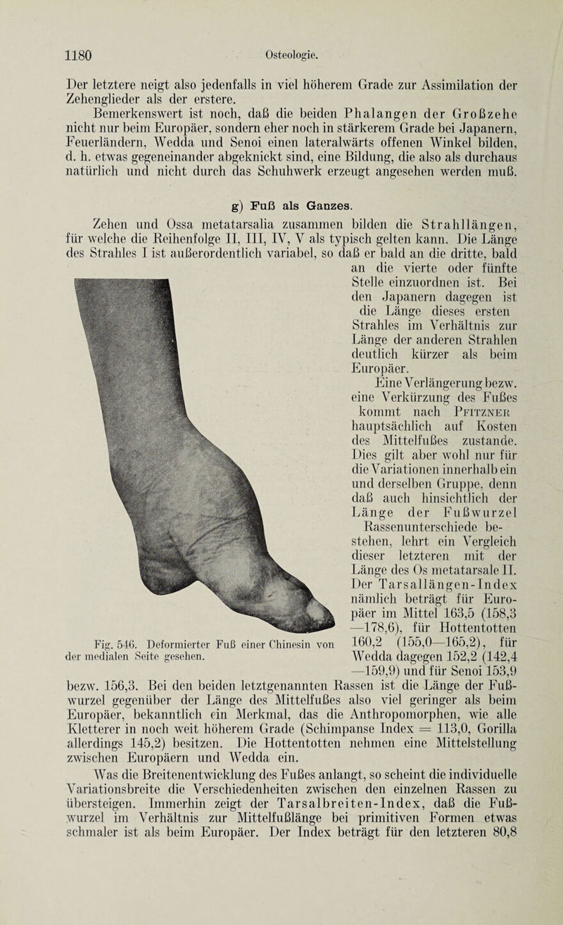Der letztere neigt also jedenfalls in viel hoherem Grade zur Assimilation der Zehenglieder als der erstere. Bemerkenswert ist noch, daB die beiden Phalangen der GroBzehe nicht nur beim Europaer, sondern eher noch in starkerem Grade bei Japanern, Feuerlandern, Wedda und Senoi einen lateralwarts offenen Winkel bilden, d. h. etwas gegeneinander abgeknickt sind, eine Bildung, die also als durchaus natiirlich und nicht durch das Schuhwerk erzeugt angesehen werden muB. g) FuB als Gauzes. Zehen und Ossa metatarsalia zusammen bilden die Strahllangen, fur welche die Reihenfolge II, III, IV, V als typisch gelten kann. Die Lange des Strahles I ist auBerordentlich variabel, so daB er bald an die dritte, bald an die vierte oder fiinfte Stelle einzuordnen ist. Bei den Japanern dagegen ist die Lange dieses ersten Strahles im Verhaltnis zur Lange der anderen Stralilen deutlich kiirzer als beim Europaer. Eine Verlangerung bezw. eine Verkiirzung des FuBes kommt nach Pfitzner hauptsachlich auf Kosten des MittelfuBes zustande. Dies gilt aber wohl nur fiir die Variationen innerhalb ein und derselben Gruppe, denn daB auch hinsichtlich der Lange der FuBwurzel Rassenunterschiede be- stehen, lehrt ein Vergleich dieser letzteren mit der Lange des Os metatarsale II. Der Tarsallangen-Index namlich betragt fiir Euro¬ paer im Mittel 163,5 (158,3 —178.6), fiir Hottentotten 160,2' (155,0—165,2), fiir Wedda dagegen 152,2 (142,4 —159,9) und fiir Senoi 153,9 bezw. 156,3. Bei den beiden letztgenannten Rassen ist die Lange der FuB¬ wurzel gegeniiber der Lange des MittelfuBes also viel geringer als beim Europaer, bekanntlicli cin Merkmal, das die Anthropomorphen, wie alle Kletterer in noch weit hoherem Grade (Schimpanse Index — 113,0, Gorilla allerdings 145,2) besitzen. Die Hottentotten nehmen eine Mittelstellung zwischen Europaern und Wedda ein. Was die Breitenentwicklung des FuBes anlangt, so scheint die individuelle Variationsbreite die Verschiedenheiten zwischen den einzelnen Rassen zu iibersteigen. Immerhin zeigt der Tarsalbreiten-Index, daB die FuB¬ wurzel im Verhaltnis zur MittelfuBlange bei primitiven Formen etwas schmaler ist als beim Europaer. Der Index betragt fiir den letzteren 80,8 Fig. 546. Deformierter FuB einer Chinesin von der medialen Seite gesehen.