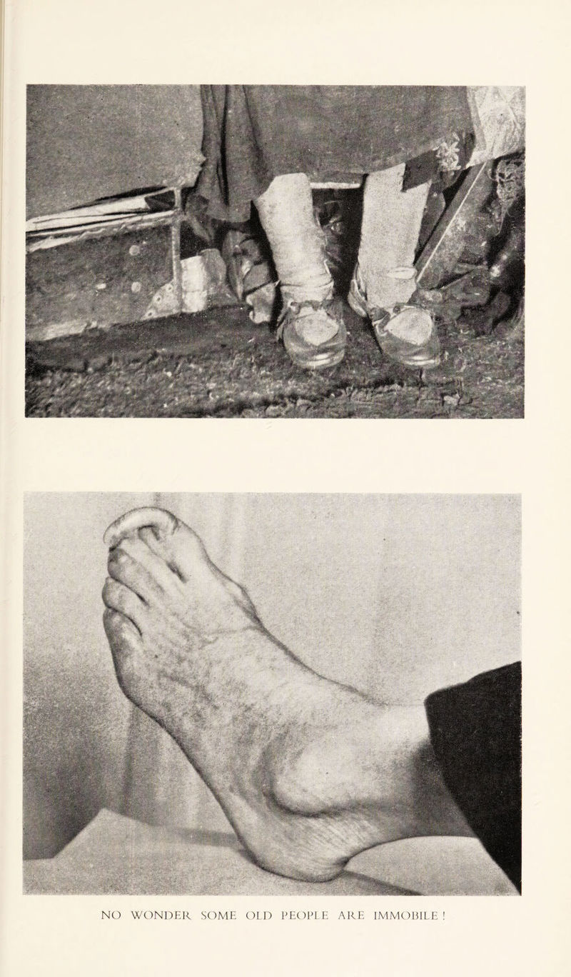 NO WONDER SOME OLD PEOPLE ARE IMMOILILE !