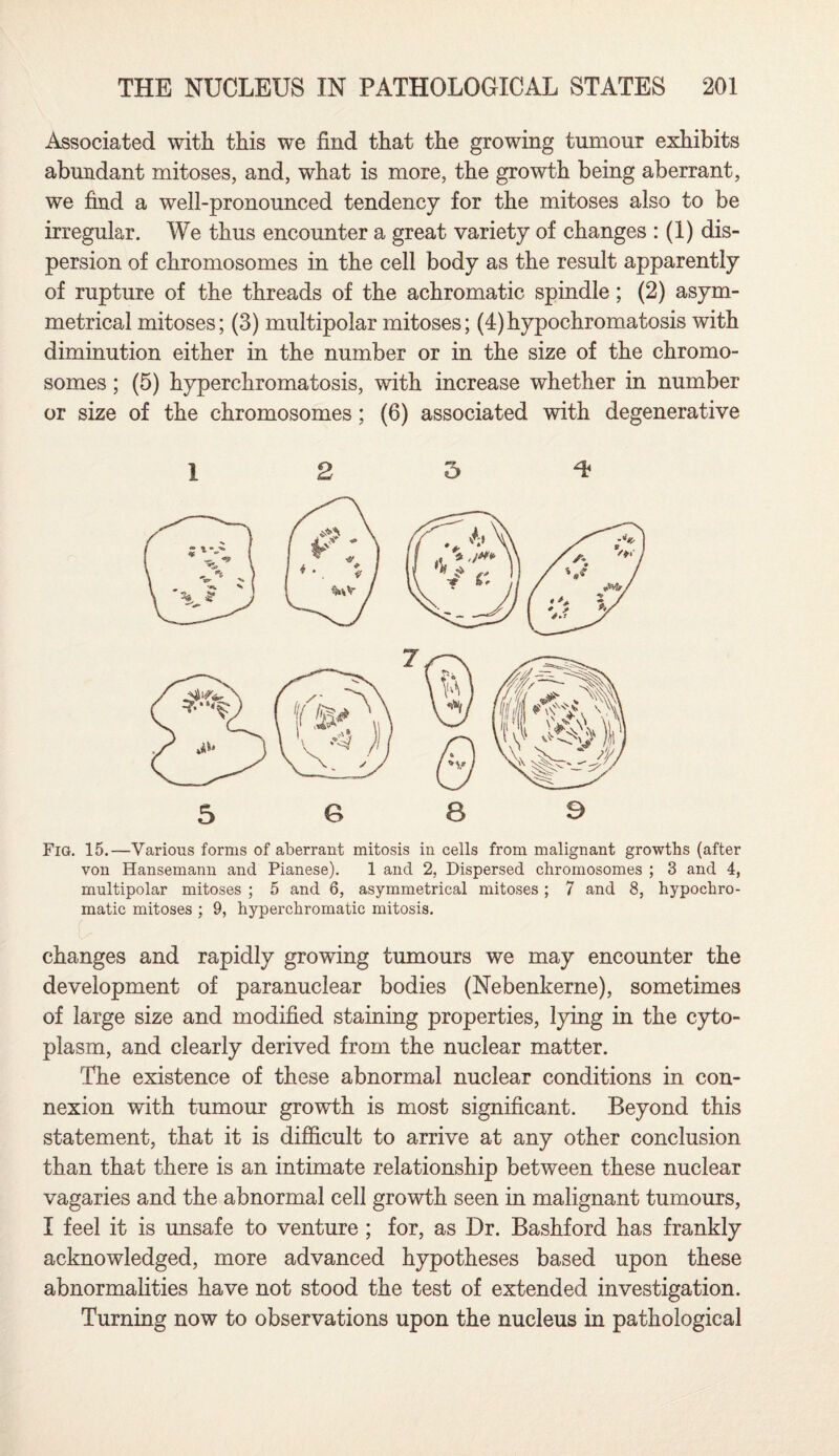 Associated with this we find that the growing tumour exhibits abundant mitoses, and, what is more, the growth being aberrant, we find a well-pronounced tendency for the mitoses also to be irregular. We thus encounter a great variety of changes : (1) dis¬ persion of chromosomes in the cell body as the result apparently of rupture of the threads of the achromatic spindle; (2) asym¬ metrical mitoses; (3) multipolar mitoses; (4)hypochromatosis with diminution either in the number or in the size of the chromo¬ somes ; (5) hyperchromatosis, with increase whether in number or size of the chromosomes; (6) associated with degenerative 12 5^ Fig. 15.—Various forms of aberrant mitosis in cells from malignant growths (after von Hansemann and Pianese). 1 and 2, Dispersed chromosomes ; 3 and 4, multipolar mitoses ; 5 and 6, asymmetrical mitoses ; 7 and 8, hypoehro- matic mitoses ; 9, hyperchromatic mitosis. changes and rapidly growing tumours we may encounter the development of paranuclear bodies (Nebenkerne), sometimes of large size and modified staining properties, lying in the cyto¬ plasm, and clearly derived from the nuclear matter. The existence of these abnormal nuclear conditions in con¬ nexion with tumour growth is most significant. Beyond this statement, that it is difficult to arrive at any other conclusion than that there is an intimate relationship between these nuclear vagaries and the abnormal cell growth seen in malignant tumours, I feel it is unsafe to venture ; for, as Dr. Bashford has frankly acknowledged, more advanced hypotheses based upon these abnormalities have not stood the test of extended investigation. Turning now to observations upon the nucleus in pathological