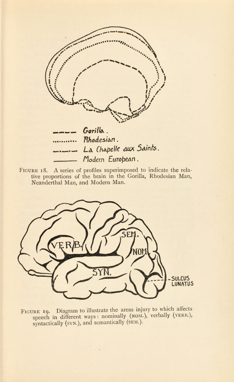 _Gorilla . . Rhodesian. _La ChapeKe dux Saints. _— Modern European . Figure iS. A series of profiles superimposed to indicate the rela¬ tive proportions of the brain in the Gorilla, Rhodesian Man, Neanderthal Man, and Modern Man. -SULCUS LUNATUS Figure ig. Diagram to illustrate the areas injury to which allects speech in different ways : nominally (nom.), verbally (verb.), syntactically (syn.), and semantically (sem.).