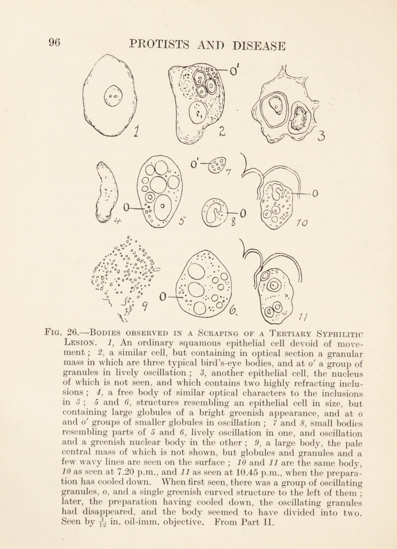 Fig. 26.—Bodies observed in a Scraping of a Tertiary Syphilitic Lesion. 1, An ordinary squamous epithelial cell devoid of move¬ ment ; 2, a similar cell, but containing in optical section a granular mass in which are three typical bird’s-eye bodies, and at o' a group of granules in lively oscillation ; 3, another epithelial cell, the nucleus of which is not seen, and which contains two highly refracting inclu¬ sions ; 4, a free body of similar optical characters to the inclusions in 3 ; 5 and 6, structures resembling an epithelial cell in size, but containing large globules of a bright greenish ajipearance, and at o and o' groups of smaller globules in oscillation ; 7 and 8, small bodies resembling parts of 5 and 6, lively oscillation in one, and oscillation and a greenish nuclear body in the other ; 9, a large body, the pale central mass of which is not shown, but globules and granules and a few wavy lines are seen on the surface ; 10 and 11 are the same body, 10 as seen at 7.20 p.m., and 11 as seen at 10.45 p.m., when the prepara¬ tion has cooled down. When first seen, there was a group of oscillating granules, o, and a single greenish curved structure to the left of them ; later, the preparation having cooled down, the oscillating granules had disappeared, and the body seemed to have divided into two. Seen by y2- in. oil-imm. objective. From Part II.