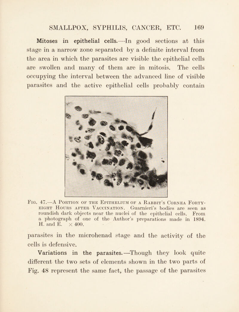 Mitoses in epithelial cells.—-In good sections at this stage in a narrow zone separated by a definite interval from the area in which the parasites are visible the epithelial cells are swollen and many of them are in mitosis. The cells oecnpying the interval between the advanced line of visible parasites and the active epithelial cells probably contain ' Fig. 47.—A Portion of the Epithelium of a Rabbit’s Cornea Forty- eight Hours after Vaccination. Guarnieri’s bodies are seen as roundish dark objects near the nuclei of the epithelial cells. From a photograph of one of the Author’s preparations made in 1894. H, and E. x 400. parasites in the microhenad stage and the activity of the cells is defensive. Variations in the parasites.—Though they look quite different the two sets of elements shown in the two parts of Fig. 48 represent the same fact, the passage of the parasites