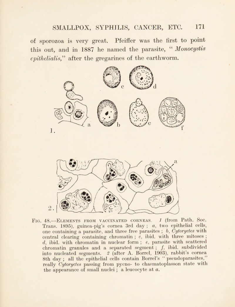 of sporozoa is very great. Pfeiffer was the first to point this out, and in 1887 he named the parasite, “ Monocystis epithelialis,” after the gregarines of the earthworm. Fig. 48.—Elements from vaccinated corneas. 1 (from Path. Soc. Trans. 1895), guinea-pig’s cornea 3rd day ; a, two epithelial cells, one containing a parasite, and three free parasites ; b, Cytoryctes with central clearing containing chromatin ; c, ibid, with three mitoses ; d, ibid, with chromatin in nuclear form ; e, parasite with scattered chromatin granules and a separated segment ; /, ibid, subdivided into nucleated segments. 2 (after A. Borrel, 1903), rabbit’s cornea 8th day ; all the epithelial cells contain Borrel’s 41 pseudoparasites,’ really Cytoryctes passing from pyeno- to chasmatoplasson state with the appearance of small nuclei ; a leucocyte at a.