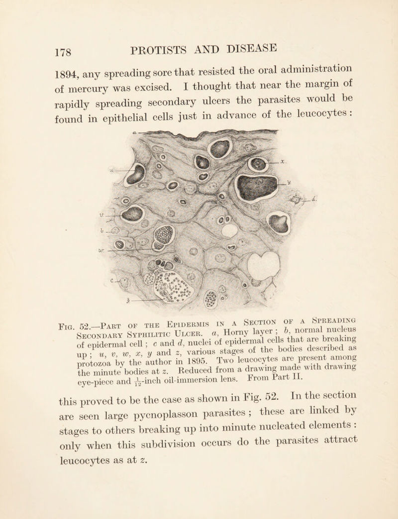 1894, any spreading sore that resisted the oral administration of mercury was excised. I thought that near the margin of rapidly spreading secondary ulcers the parasites would be found in epithelial cells just in advance of the leucocytes : Fig. 52_Part of the Epidermis in a Section of a Spreading Secondary Syphilitic Ulcer, a, Horny layer; b normal nucleus of epidermal cell; c and d, nuclei of epidermal cehs that are freaking un • u v w, x, y and z, various stages of the bodies described as protozoa by the author in 1895. Two leucocytes are present among the minute^bodies at z. Reduced from a drawing made with draw n g eye-piece and A inch oil-immersion lens. From Fart 1 . this proved to be the case as shown in Fig. 52. In the section are seen large pycnoplasson parasites ; these are linked by stages to others breaking up into minute nucleated elements : only when this subdivision occurs do the parasites attract leucocytes as at z.