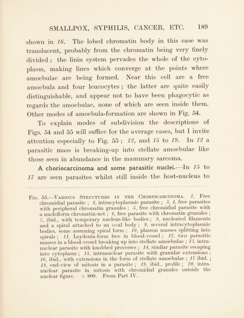 shown in 16. The lobed chromatin body in this case was translucent, probably from the chromatin being very finely divided ; the linin system pervades the whole of the cyto¬ plasm, making lines which converge at the points where amoebnlae are being formed. Near this cell are a free amoebula and four leucocytes ; the latter are quite easily distinguishable, and appear not to have been phagocytic as regards the amoebulae, none of which are seen inside them. Other modes of amoebula-formation are shown in Fig. 54. To explain modes of subdivision the descriptions of Figs. 54 and 55 will suffice for the average cases, but I invite attention especially to Fig. 55 ; 12, and 15 to 19. In 12 a parasitic mass is breaking-up into stellate amoebulae like those seen in abundance in the mammary sarcoma. A choriocarcinoma and some parasitic nuclei.—In 15 to 17 are seen parasites whilst still inside the host-nucleus to Fig. 55.—Various Structures in the Choriocarcinoma. 1, Free chromidial parasite ; 2, intracytoplasmic parasite ; 3, 4, free parasites with peripheral chromatin granules ; 5, free chromidial parasite with a nucleiform chromatin-net ; 6, free parasite with chromatin granules ; 7, ibid., with temporary nucleus-like bodies ; 8, nucleated filaments and a spiral attached to an oval body ; 9, several intracytoplasmic bodies, some assuming spiral form ; 10, plasson masses splitting into spirals ; 11, Leydenia-form free in blood-vessel ; 12, two parasitic masses in a blood-vessel breaking up into stellate amoebulae ; 13, intra¬ nuclear parasite with knobbed processes ; 14, similar parasite escaping into cytoplasm ; 15, intranuclear parasite with granular extensions ; 16, ibid., with extensions in the form of stellate amoebulae ; 17 ibid. ; 18, end-view of mitosis in a parasite ; 19, ibid., profile ; 20, intra¬ nuclear parasite in mitosis with chromidial granules outside the nuclear figure. X 800. From Part IV.
