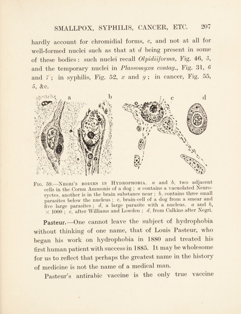 hardly account for chromidial forms, c, and not at all for well-formed nuclei such as that at d being present in some of these bodies : such nuclei recall Olpidiiforma, Fig. 46, 3, and the temporary nuclei in Plassomyxa contag., Fig. 31, 6 and 7 ; in syphilis, Fig. 52, x and y ; in cancer, Fig. 55, 5, &c. Yig. 59._Negri’s bodies in Hydrophobia, a and b, two adjacent cells in the Cornn Ammonis of a dog ; a contains a vacuolated Neuro- ryctes, another is in the brain substance near \ b, contains three small parasites below the nucleus j c, brain-cell of a dog from a smear and five large parasites ; d, a large parasite with a nucleus, a and b, X 1000 ; c, after Williams and Lowden ; d, from Calkins after Negri. Pasteur.—One cannot leave the subject of hydrophobia without thinking of one name, that of Louis Pasteur, who began his work on hydrophobia in 1880 and treated his first human patient with success in 1885. It may be wholesome for us to reflect that perhaps the greatest name in the history of medicine is not the name of a medical man. Pasteur’s antirabic vaccine is the only true vaccine