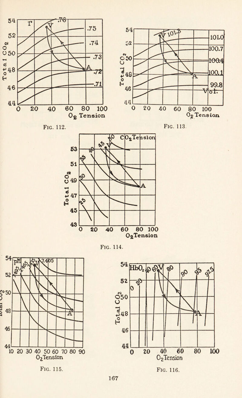TDIrtT 0$> Tension Og Tension 0 20 40 60 80 100 OgTension O^Tension 02Tension