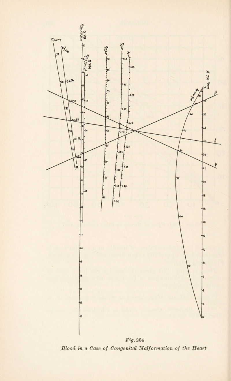 Fig. 204 Blood in a Case of Congenital Malformation of the Heart vof. y.