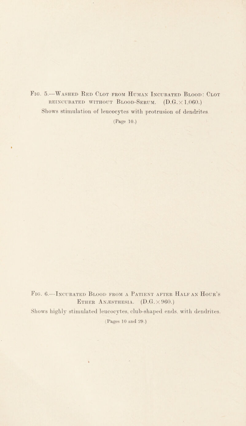 Fig. 5.—Washed Red Clot from Human Incubated Blood: Clot REINCUBATED WITHOUT BlOOD-SeRUM. (D.Gr.X 1,060.) Shows stimulation of leucocytes with protrusion of dendrites. (Page 10.) I Fig. 6.—Incubated Blood from a Patient after Hale an Hour’s Ether Anaesthesia. (D.G.X960.) Shows highly stimulated leucocytes, club-shaped ends, with dendrites.