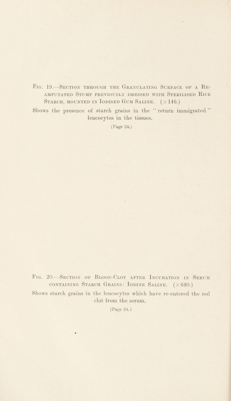 Fig. 19.—Section through the Granulating Surface of a Re¬ amputated Stump previously dressed with Sterilised Rice Starch, mounted in Iodised Gum Saline, (x 146.) Shows the presence of starch grains in the “return immigrated” leucocytes in the tissues. (Page 24.) Fig. 20.—Section of Blood-Clot after Incubation in Serum containing Starch Grains: Iodine Saline. (x640.) Shows starch grains in the leucocytes which have re-entered the red clot from the serum.