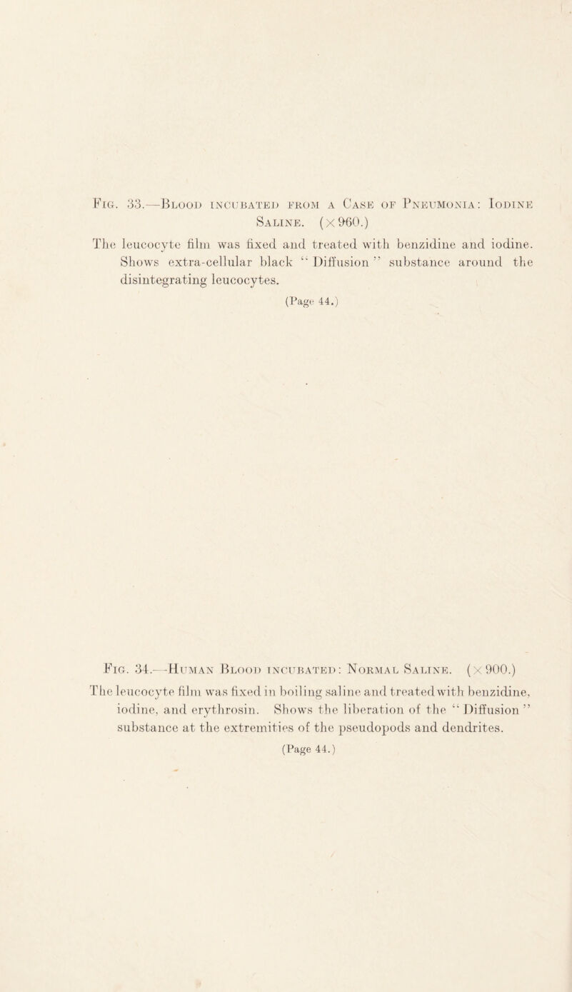 Fig. 33.—Blood incubated from a Case of Pneumonia: Iodine Saline. (x%0.) The leucocyte film was fixed and treated with benzidine and iodine. J Shows extra-cellular black Diffusion ” substance around the disintegrating leucocytes. (Page 44.) Fig. 34.-—-Hitman Blood incubated: Normal Saline. (x9Q0.) The leucocyte film was fixed in boiling saline and treated with benzidine, iodine, and erythrosin. Shows the liberation of the “ Diffusion ” substance at the extremities of the pseudopods and dendrites.