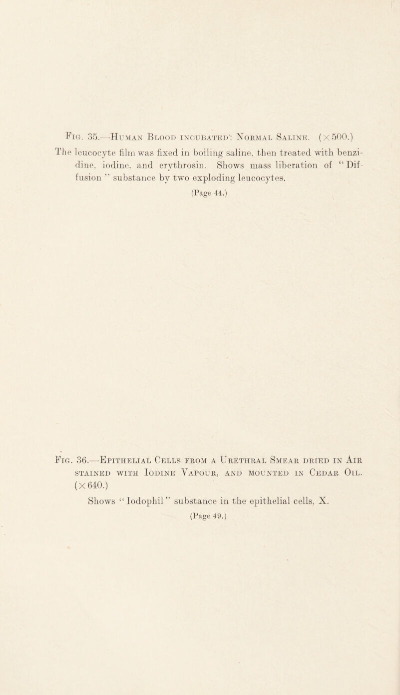 Fig. 35.—Human Blood incubated': Normal Saline. (x500.) The leucocyte film was fixed in boiling saline, then treated with benzi¬ dine, iodine, and erythrosin. Shows mass liberation of “ Dif fusion ” substance by two exploding leucocytes. (Page 44.) Fig. 36.—Epithelial Cells from a Urethral Smear dried in Air STAINED WITH IODINE VAPOUR, AND MOUNTED IN CEDAR OlL. (X 640.) Shows “Iodophil” substance in the epithelial cells, X.