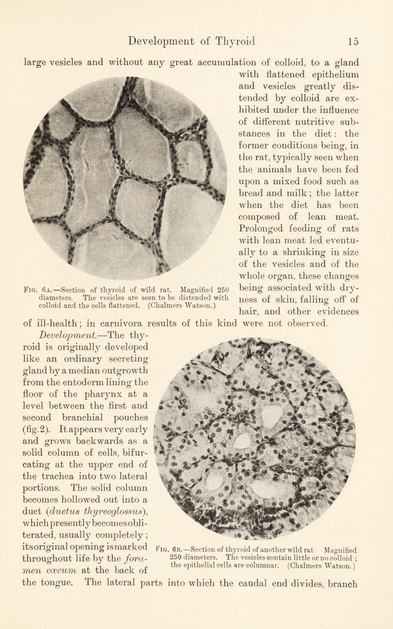 large vesicles and without any great accumulation of colloid, to a gland with flattened epithelium and vesicles greatly dis¬ tended by colloid are ex¬ hibited under the influence of different nutritive sub¬ stances in the diet: the former conditions being, in the rat, typically seen when the animals have been fed upon a mixed food such as bread and milk; the latter when the diet has been composed of lean meat. Prolonged feeding of rats with lean meat led eventu¬ ally to a shrinking in size of the vesicles and of the whole organ, these changes being associated with dry¬ ness of skin, falling off of hair, and other evidences of ill-health; in carnivora results of this kind were not observed. Development.—The thy¬ roid is originally developed like an ordinary secreting gland by a median outgrowth from the entoderm lining the floor of the pharynx at a level between the first and second branchial pouches (fig. 2). It appears very early and grows backwards as a solid column of cells, bifur¬ cating at the upper end of the trachea into two lateral portions. The solid column becomes hollowed out into a duct (<ductus thyreoglossus), which presently becomes obli¬ terated, usually completely; its original opening is marked Fig. 6E<—Section of thyroid of another wild rat. Magnified throughout life by the fova- 250 diameters. The vesicles contain little or no colloid ; , -i -| 0 the epithelial cells are columnar. (Chalmers Watson.) men ccecum at the back of the tongue. The lateral parts into which the caudal end divides, branch Fig. 6a.—Section of thyroid of wild rat. Magnified 250 diameters. The vesicles are seen to be distended with colloid and the cells flattened. (Chalmers Watson.)