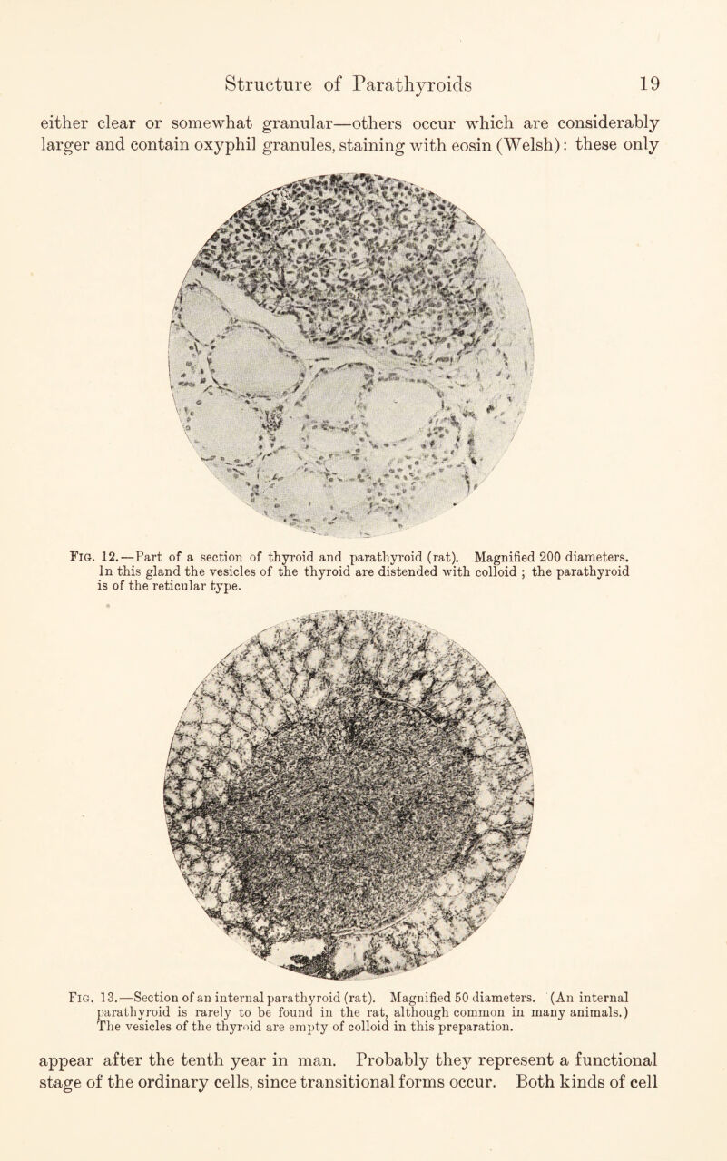 either clear or somewhat granular—others occur which are considerably larger and contain oxyphi] granules, staining with eosin (Welsh): these only Fig. 12.—Part of a section of thyroid and parathyroid (rat). Magnified 200 diameters. In this gland the vesicles of the thyroid are distended with colloid ; the parathyroid is of the reticular type. Fig. 13.—Section of an internal parathyroid (rat). Magnified 50 diameters. (An internal parathyroid is rarely to be found in the rat, although common in many animals.) The vesicles of the thyroid are empty of colloid in this preparation. appear after the tenth year in man. Probably they represent a functional stage of the ordinary cells, since transitional forms occur. Both kinds of cell