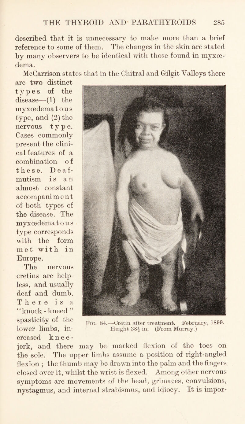 described that it is unnecessary to make more than a brief reference to some of them. The changes in the skin are stated by many observers to be identical with those found in myxoe- dema. McCarrison states that in the Chitral and Gilgit Valleys there are two distinct types of the disease- -(i) the myxoedema t o u s type, and (2) the nervous type. Cases commonly present the clini¬ cal features of a combination o f these. Deaf- mutism is an almost constant accompani m e n t of both types of the disease. The myxoedema t o u s type corresponds with the form met with in Europe. The nervous cretins are help¬ less, and usually deaf and dumb. There is a “knock - kneed ” spasticity of the lower limbs, in¬ creased knee- jerk, and there may be marked flexion of the toes on the sole. The uj)per limbs assume a position of right-angled flexion ; the thumb may be drawn into the palm and the fingers closed over it, whilst the wrist is flexed. Among other nervous symptoms are movements of the head, grimaces, convulsions, nystagmus, and internal strabismus, and idiocy, It is impor- Fig. 84.—Cretin after treatment. February, 1899. Height 381 in. (From Murray.)