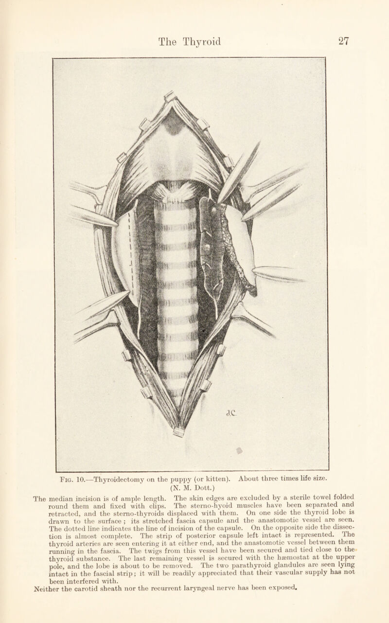 Fig. 10.—Thyroidectomy on the puppy (or kitten). About three times life size. (N. M. Dott.) The median incision is of ample length. The skin edges are excluded by a sterile towel folded round them and fixed with clips. The sterno-hyoid muscles have been separated and retracted, and the stemo-thyroids displaced with them. On one side the thyroid lobe is drawn to the surface ; its stretched fascia capsule and the anastomotic vessel are seen. The dotted line indicates the line of incision of the capsule. On the opposite side the dissec¬ tion is almost complete. The strip of posterior capsule left intact is represented. The thyroid arteries are seen entering it at either end, and the anastomotic vessel between them running in the fascia. The twigs from this vessel have been secured and tied close to the thyroid substance. The last remaining vessel is secured with the lisemostat at the upper pole, and the lobe is about to be removed. The two parathyroid glandules are seen lying- intact in the fascial strip; it will be readily appreciated that their vascular supply has not been interfered with. Neither the carotid sheath nor the recurrent laryngeal nerve has been exposed.