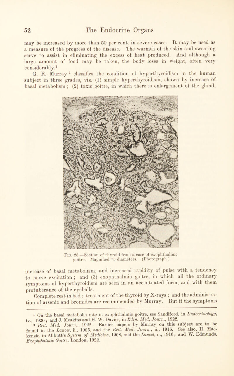 may be increased by more than 50 per cent, in severe cases. It may be used as a measure of the progress of the disease. The warmth of the skin and sweating serve to assist in eliminating the excess of heat produced. And although a large amount of food may be taken, the body loses in weight, often very considerably.1 G. R. Murray 2 classifies the condition of hyperthyroidism in the human subject in three grades, viz. (1) simple hyperthyroidism, shown by increase of basal metabolism ; (2) toxic goitre, in which there is enlargement of the gland, Fig. 28.—Section of thyroid from a case of exophthalmic goitre. Magnified 75 diameters. (Photograph.) increase of basal metabolism, and increased rapidity of pulse with a tendency to nerve excitation ; and (3) exophthalmic goitre, in which all the ordinary symptoms of hyperthyroidism are seen in an accentuated form, and with them protuberance of the eyeballs. Complete rest in bed ; treatment of the thyroid by X-rays ; and the administra¬ tion of arsenic and bromides are recommended by Murray. But if the symptoms 1 On the basal metabolic rate in exophthalmic goitre, see Sandiford, in Endocrinology, iv., 1920 ; and J. Meakins and H. W. Davies, in Edin. Med. Journ., 1922. 2 Brit. Med. Journ., 1922. Earlier papers by Murray on this subject are to be found in the Lancet, ii., 1905, and the Brit. Med. Journ., ii., 1916. See also, H. Mac¬ kenzie, in Allbutt’s System of Medicine, 1908, and the Lancet, ii., 1916; and W. Edmunds, Exophthalmic Goitre, London, 1922.