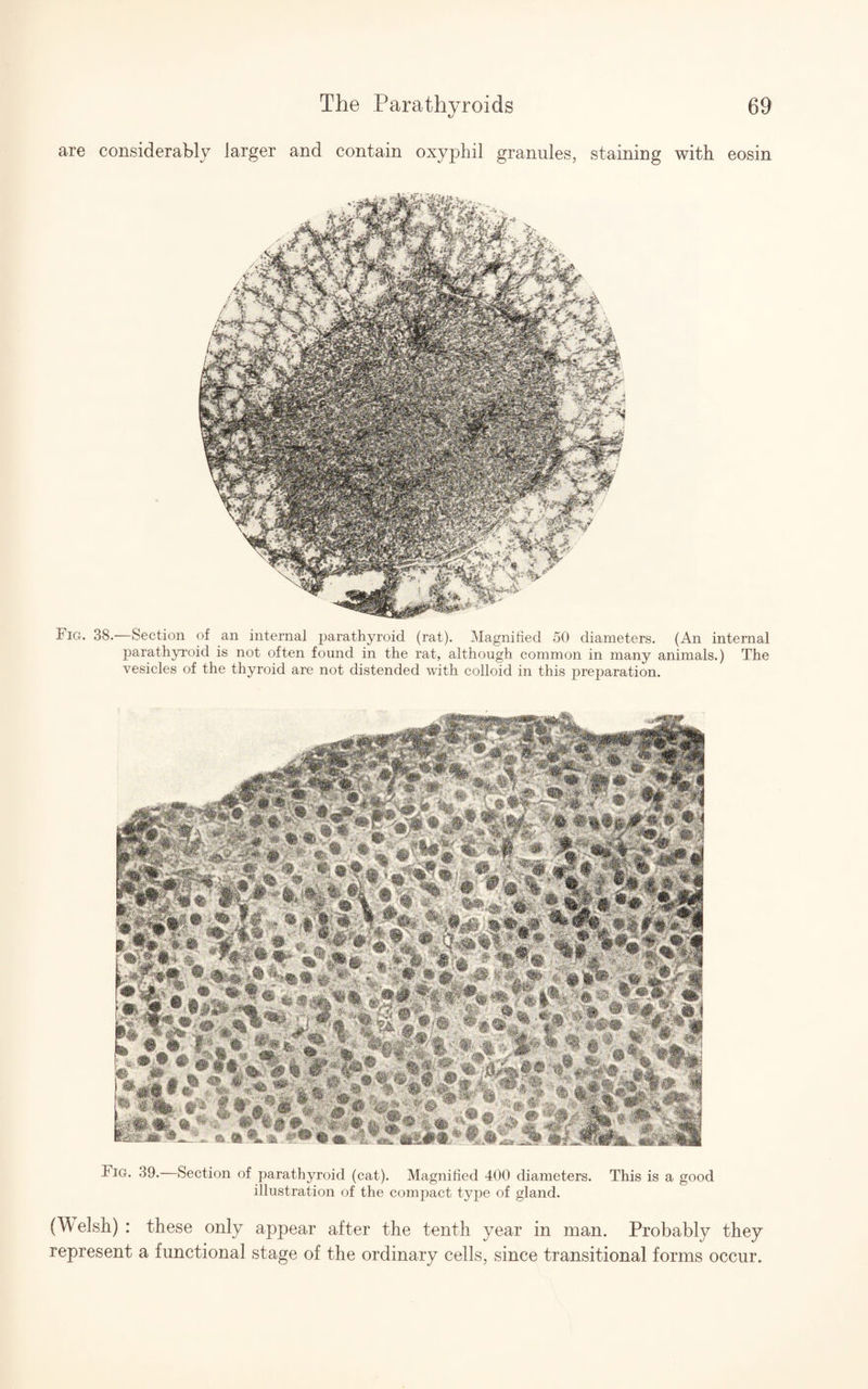 are considerably larger and contain oxyphil granules, staining with eosin Fig. 38.—Section of an internal parathyroid (rat). Magnified 50 diameters. (An internal parathyroid is not often found in the rat, although common in many animals.) The vesicles of the thyroid are not distended with colloid in this preparation. tiG. 39.—Section of parathyroid (cat). Magnified 400 diameters. This is a good illustration of the compact type of gland. ('Welsh) : these only appear after the tenth year in man. Probably they represent a functional stage of the ordinary cells, since transitional forms occur.