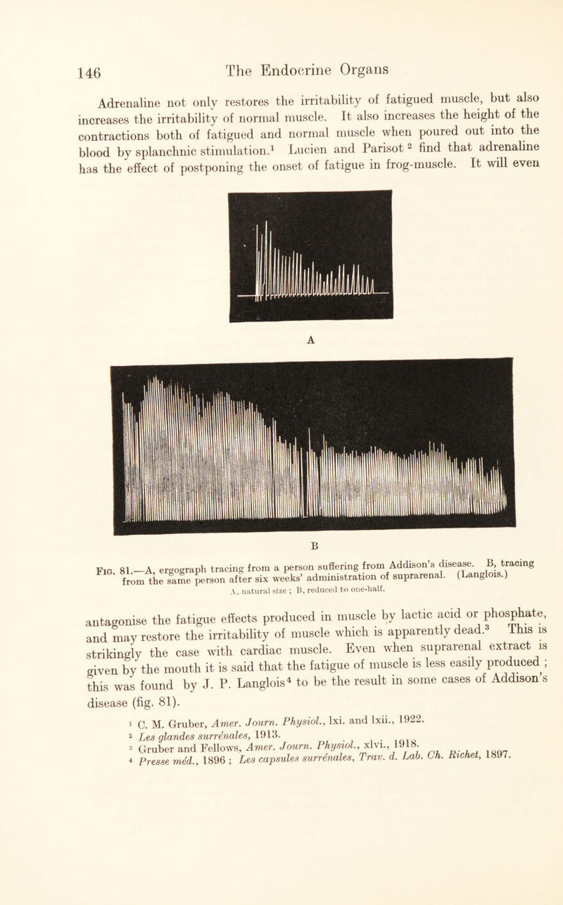 Adrenaline not only restores the irritability of fatigued muscle, but also increases the irritability of normal muscle. It also increases the height of the contractions both of fatigued and normal muscle when poured out into the blood by splanchnic stimulation.1 Lucien and Parisot2 find that adrenaline has the effect of postponing the onset of fatigue in frog-muscle. It will even Fig. 81.—A, ergograph tracing from a person suffering from Addison’s disease. B tracing from the same person after six weeks’ administration of suprarenal. (Langlois.) \ natural size : B, reduced to one-half. antagonise the fatigue effects produced in muscle by lactic acid or phosphate, and may restore the irritability of muscle which is apparently dead.3 This is strikingly the case with cardiac muscle. Even when suprarenal extract is given by the mouth it is said that the fatigue of muscle is less easily produced ; this was found by J. P. Langlois4 to be the result in some cases of Addison s disease (fig. 81). 1 2 3 4 M. Gruber, Amer. Journ. Physiol., lxi. and lxii., 1922. s glandes surrenales, 1913. uber and Fellows, Amer. Journ. Physiol, xlvi.,1918 esse med., 1896 ; Les capsules surrenales, Trav. d. Lab. LH. Kichet, loy/.