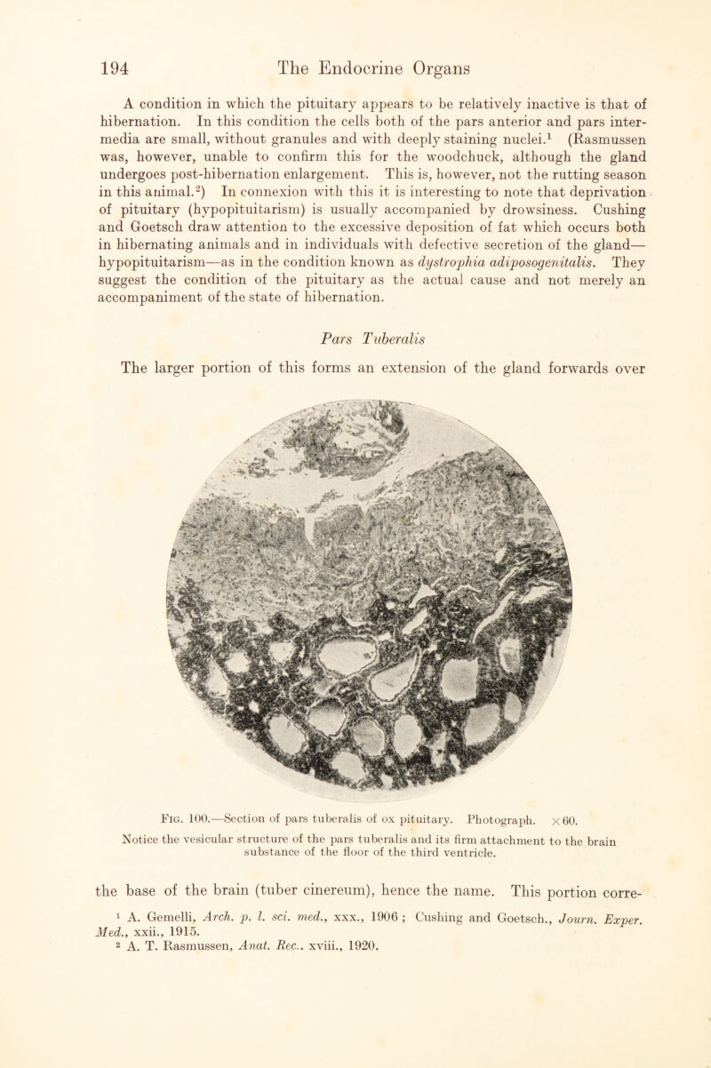 A condition in which the pituitary appears to be relatively inactive is that of hibernation. In this condition the cells both of the pars anterior and pars inter¬ media are small, without granules and with deeply staining nuclei.^ (Easmussen was, however, unable to confirm this for the woodchuck, although the gland undergoes post-hibernation enlargement. This is, however, not the rutting season in this animal.'^) In connexion with this it is interesting to note that deprivation of pituitary (hypopituitarism) is usually accompanied by drowsiness. Cushing and Goetsch draw attention to the excessive deposition of fat which occurs both in hibernating animals and in individuals with defective secretion of the gland— hypopituitarism—as in the condition known as dystro'pJiia adiposogenitalis. They suggest the condition of the pituitary as the actual cause and not merely an accompaniment of the state of hibernation. Pars Tuberalis The larger portion of this forms an extension of the gland forwards over Fig. 100.—Section of pars tuberalis of ox pituitary. Photograph. x60. Notice the vesicular structure of the pars tuberalis and its firm attachment to the brain substance of the floor of the third ventricle. the base of the brain (tuber cinereum), hence the name. This portion corre- 1 A. Gemelli, Arch. p. 1. sci. med., xxx., 1906 ; Cushing and Goetsch., Journ. Exper. Med., xxii., 1915. 2 A. T. Rasmussen, Anat. Rec.. xviii., 1920.