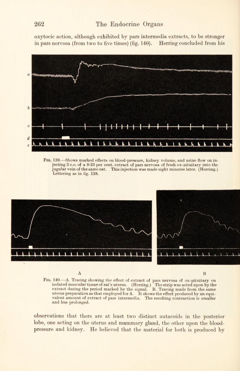 oxytocic action, although exhibited by pars intermedia extracts, to be stronger in pars nervosa (from two to five times) (fig. 140). Herring concluded from his Fia. 139.—Shows marked effects on blood-pressure, kidney volume, and urine flow on in¬ jecting 3 c.c. of a 0’25 per cent, extract of pars nervosa of fresh ox-pituitary into the jugular vein of the same cat. This injection was made eight minutes later. (Herring.) Lettering as in fig. 138. A B Fig. 140.—A. Tracing showing the effect of extract of pars nervosa of ox-pituitary on isolated muscular tissue of rat’s uterus. (Herring.) The strip was acted upon by the extract during the period marked by the signal. B. Tracing made from the same uterus preparation as that employed for A. It shows the effect produced by an equi¬ valent amount of extract of pars intermedia. The resulting contraction is smaller and less prolonged. observations that there are at least two distinct autacoids in the posterior lobe, one acting on the uterus and mammary gland, the other upon the blood- pressure and kidney. He believed that the material for both is produced by