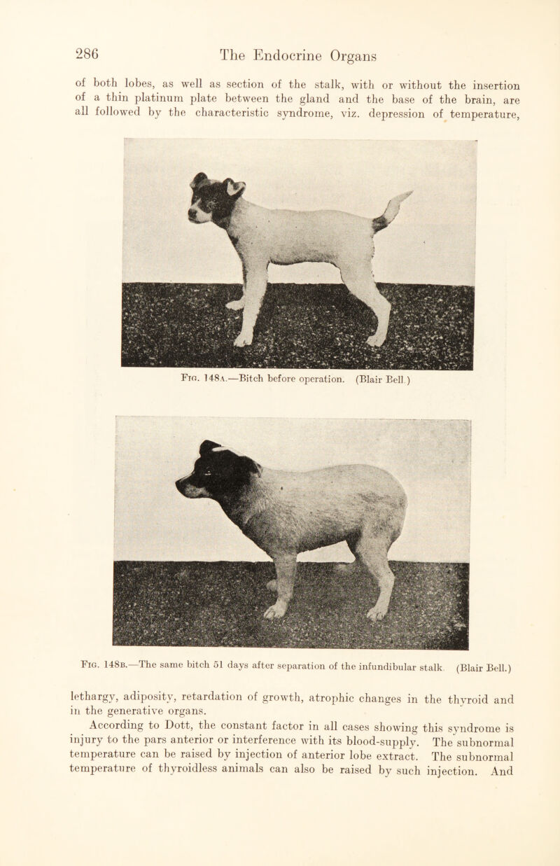 of both lobes, as well as section of the stalk, with or without the insertion of a thin platinum plate between the gland and the base of the brain, are all followed by the characteristic syndrome, viz. depression of temperature. Ftg. 148a.—Bitch before operation. (Blair Bell ) Fig. 148b.—The same bitch 51 days after separation of the infundibular stalk (Blair Bell.) lethargy, adiposity, retardation of growth, atrophic changes in the thyroid and in the generative organs. According to Dott, the constant factor in all cases showing this syndrome is injury to the pars anterior or interference with its blood-supply. The subnormal temperature can be raised by injection of anterior lobe extract. The subnormal temperature of thyroidless animals can also be raised by such injection. And