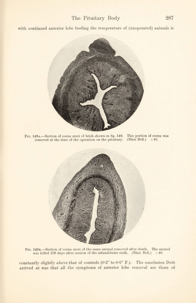 with continued anterior lobe feeding the temperature of (unoperated) animals is Fig. 149a.—Section of cornu uteri of bitch shown in fig. 148. This portion of cornu was removed at the time of the operation on the pituitary. (Blair Bell.) x40. Fig. 149b.—Section of cornu uteri of the same animal removed after death. The animal was killed 128 days after section of the infundibular stalk. (Blair Bell.) x40. constantly slightly above that of controls (0-2° to 0*6° F.). The conclusion Dott arrived at was that all the symptoms of anterior lobe removal are those of