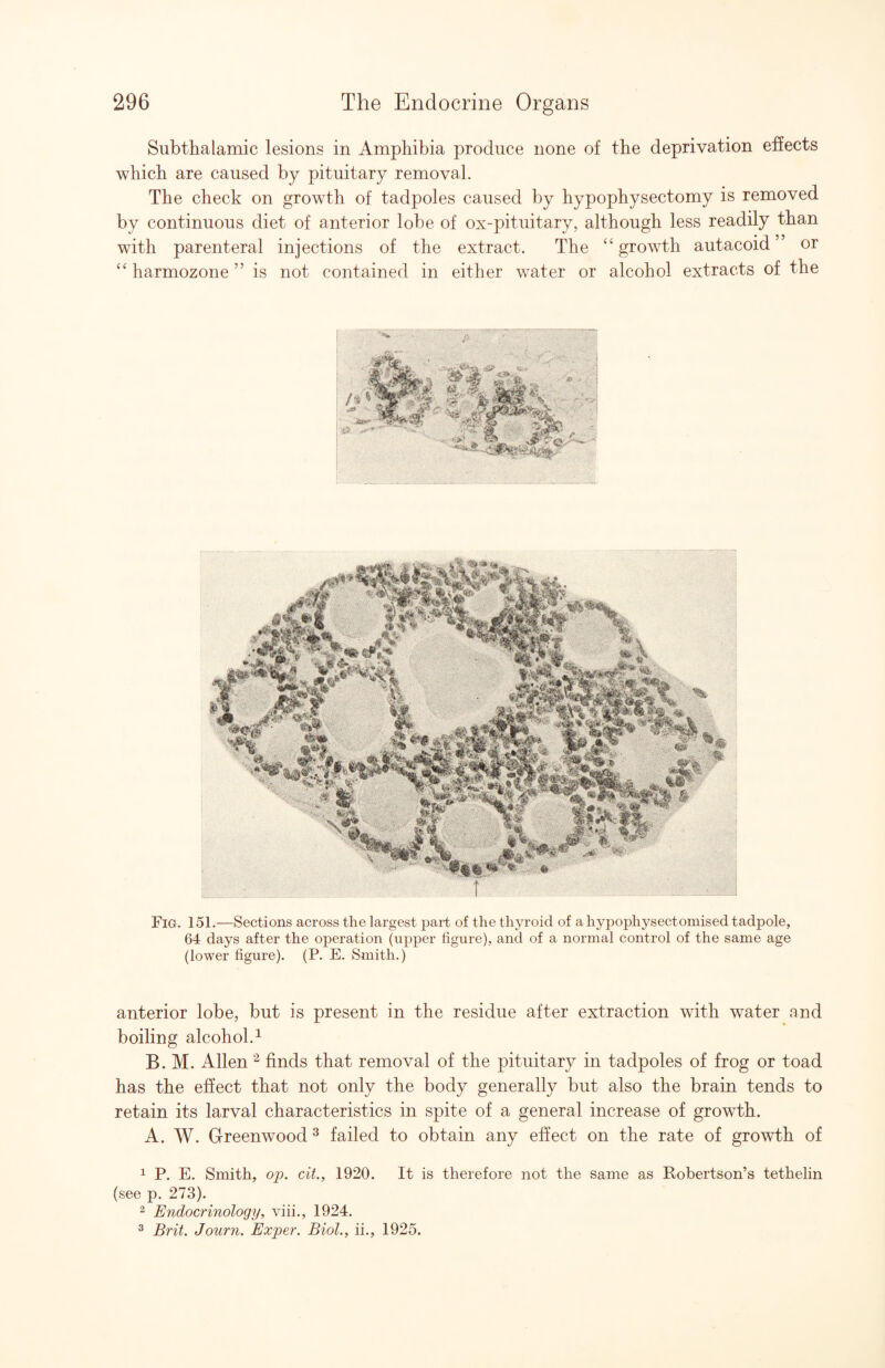 Subthalamic lesions in Amphibia produce none of the deprivation effects which are caused by pituitary removal. The check on growth of tadpoles caused by hypophysectomy is removed by continuous diet of anterior lobe of ox-pituitary, although less readily than with parenteral injections of the extract. The growth autacoid or ‘‘harmozone ” is not contained in either water or alcohol extracts of the Fig. 151.—Sections across the largest part of the thyroid of a hypophysectomised tadpole, 64 days after the operation (upper figure), and of a normal control of the same age (lower figure). (P. E. Smith.) anterior lobe, but is present in the residue after extraction with water and boiling alcohol.^ B. M. Allen finds that removal of the pituitary in tadpoles of frog or toad has the effect that not only the body generally but also the brain tends to retain its larval characteristics in spite of a general increase of growth. A. W. Greenwood ^ failed to obtain any effect on the rate of growth of 1 P. E. Smith, op. cit., 1920. It is therefore not the same as Robertson’s tethelin (see p. 273). 2 Endocrinology, viii., 1924. 2 Brit. Journ. Exper. Biol., ii., 1925.