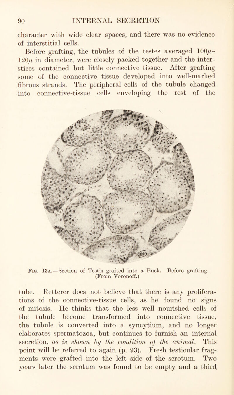 character with wide clear spaces, and there was no evidence of interstitial cells. Before grafting, the tubules of the testes averaged 100^- 120// in diameter, were closely packed together and the inter¬ stices contained but little connective tissue. After grafting some of the connective tissue developed into well-marked fibrous strands. The peripheral cells of the tubule changed into connective-tissue cells enveloping the rest of the Fig. 13a.—Section of Testis grafted into a Buck. Before grafting. (From Voronoff.) tube. Retterer does not believe that there is any prolifera¬ tions of the connective-tissue cells, as he found no signs of mitosis. He thinks that the less well nourished cells of the tubule become transformed into connective tissue, the tubule is converted into a syncytium, and no longer elaborates spermatozoa, but continues to furnish an internal secretion, as is shown hy the condition of the animal. This point will be referred to again (p. 93). Fresh testicular frag¬ ments were grafted into the left side of the scrotum. Two years later the scrotum was found to be empty and a third