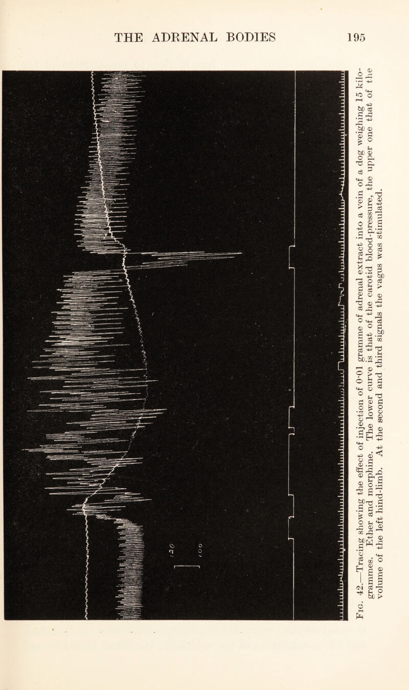 Fig. 42.—Tracing showing the effect of injection of O'Ol gramme of adrenal extract into a vein of a dog weighing 15 kilo¬ grammes. Ether and morphine. The lower curve is that of the carotid blood-pressure, the upper one that of the volume of the left hind-limb. At the second and third signals the vagus was stimulated.