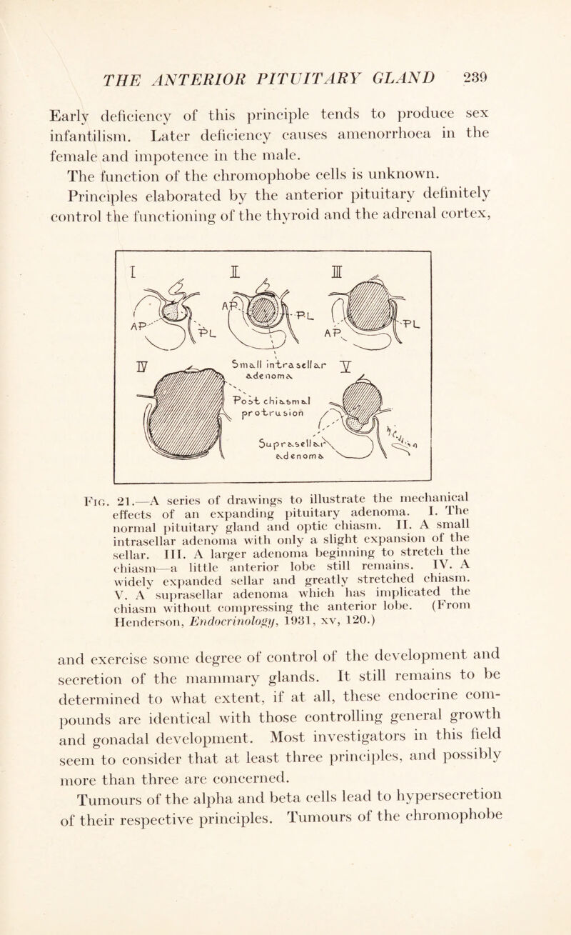 Early deficiency of this principle tends to produce sex infantilism. Later deficiency causes amenorrhoea in the female and impotence in the male. The function of the chromophobe cells is unknown. Principles elaborated by the anterior pituitary definitely control the functioning of the thyroid and the adrenal cortex, Fig. 21.—A series of drawings to illustrate the mechanical effects of an expanding pituitary adenoma. I. The normal pituitary gland and optic chiasm. II. A small intrasellar adenoma with only a slight expansion of the sellar. III. A larger adenoma beginning to stretch the chiasm—a little anterior lobe still remains. IV. A widely expanded sellar and greatly stretched chiasm. V. A suprasellar adenoma which has implicated the chiasm without compressing the anterior lobe. (From Henderson, Endocrinology, 1931, xv, 120.) and exercise some degree of control of the development and secretion of the mammary glands. It still remains to be determined to what extent, if at all, these endocrine com¬ pounds are identical with those controlling general growth and gonadal development. Most investigators in this field seem to consider that at least three principles, and possibly more than three are concerned. Tumours of the alpha and beta cells lead to hyperseeiction of their respective principles. Tumours of the chromophobe