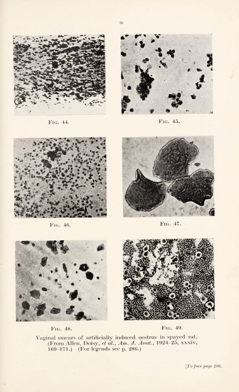 Fig. 44. Fig. 45. Fig. 48. Fig. 49. Vaginal smears of artificially induced oestrus in spayed rat. (From Allen, Doisy, et al., Am. ./. Anat., 1924-25, xxxiv, 169-171.) (For legends see p. 286.) [To face page 280.