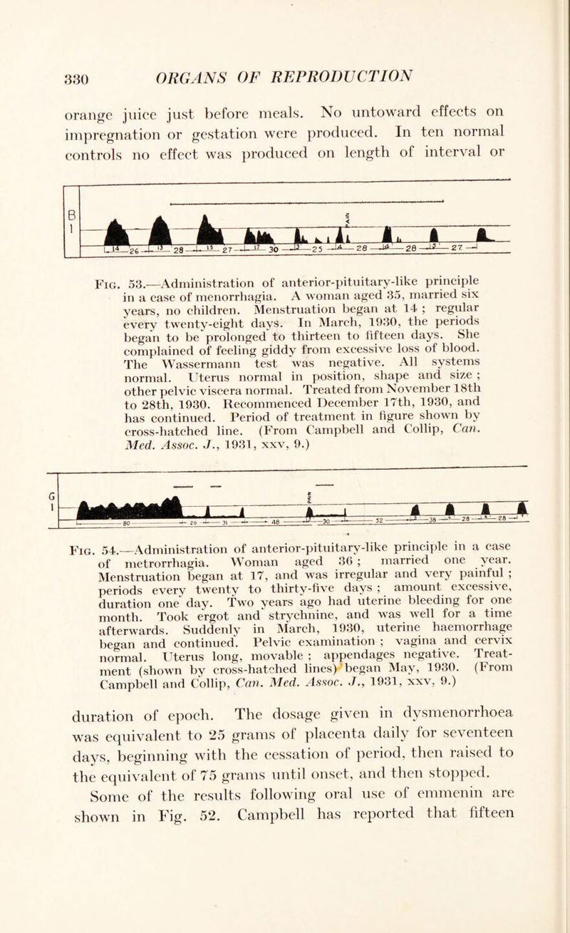 orange juice just before meals. No untoward effects on impregnation or gestation were produced. In ten normal controls no effect was produced on length of interval or Fig. 53.—Administration of anterior-pituitary-like principle in a case of menorrhagia. A woman aged 35, married six years, no children. Menstruation began at 14 ; regular every twenty-eight days. In March, 1930, the periods began to be prolonged to thirteen to fifteen days. She complained of feeling giddy from excessive loss of blood. The Wassermann test was negative. All systems normal. Uterus normal in position, shape and size ; other pelvic viscera normal. Treated from November 18th to 28th, 1930. Recommenced December 17th, 1930, and has continued. Period of treatment in figure shown by cross-hatched line. (From Campbell and Collip, Can. Med. Assoc. J., 1931, xxv, 9.) Fig. 54.—Administration of anterior-pituitary-like principle in a case of metrorrhagia. Woman aged 36 ; married one year. Menstruation began at 17, and was irregular and very painful ; periods every twenty to thirty-five days ; amount excessive, duration one day. Two years ago had uterine bleeding for one month. Took ergot and* strychnine, and was well for a time afterwards. Suddenly in March, 1930, uterine haemorrhage began and continued. Pelvic examination ; vagina and cervix normal. Uterus long, movable ; appendages negative. Ireat- ment (shown by cross-hatched lines) began May, 1930. (From Campbell and Collip, Can. Med. Assoc. J., 1931, xxv, 9.) duration of epoch. The dosage given in dysmenorrhoea was equivalent to 25 grains of placenta daily for seventeen days, beginning with the cessation of period, then raised to the equivalent of 75 grains until onset, and then stopped. Some of the results following oral use of emmenin are shown in Fig. 52. Campbell has reported that fifteen