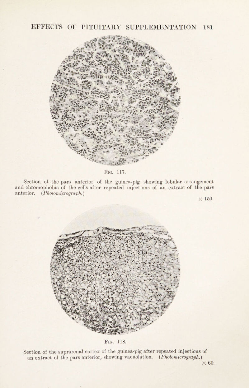 Fig. 117. Section of the pars anterior of and chromophobia of the cells after anterior. {Photomicrograph.) the guinea-pig showing lobular arrangement repeated injections of an extract of the pars X 150. Fig. 118. Section of the suprarenal cortex of the guinea-pig after repeated injections of an extract of the pars anterior, showing vacuolation. {Photomicrograph.) X 60.