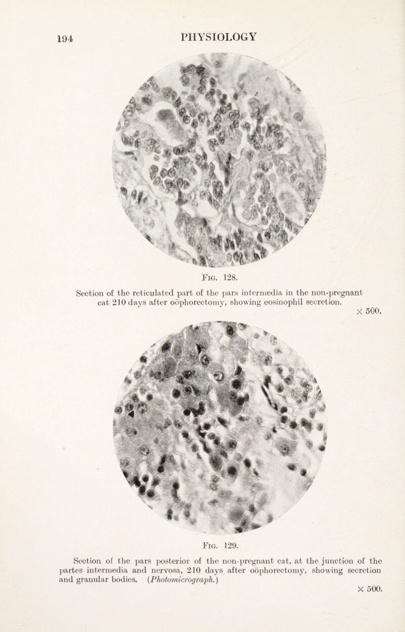 iS» Fig. 128. Section of the reticulated part of the pars intermedia in the non-pregnant cat 210 days after oophorectomy, showing eosinophil secretion. X 500. Fig. 129. Section of the pars posterior of the non-pregnant cat, at the junction of the partes intermedia and nervosa, 210 days after oophorectomy, showing secretion and granular bodies. {Photomicrograph.) HX. ' ■* X 500.
