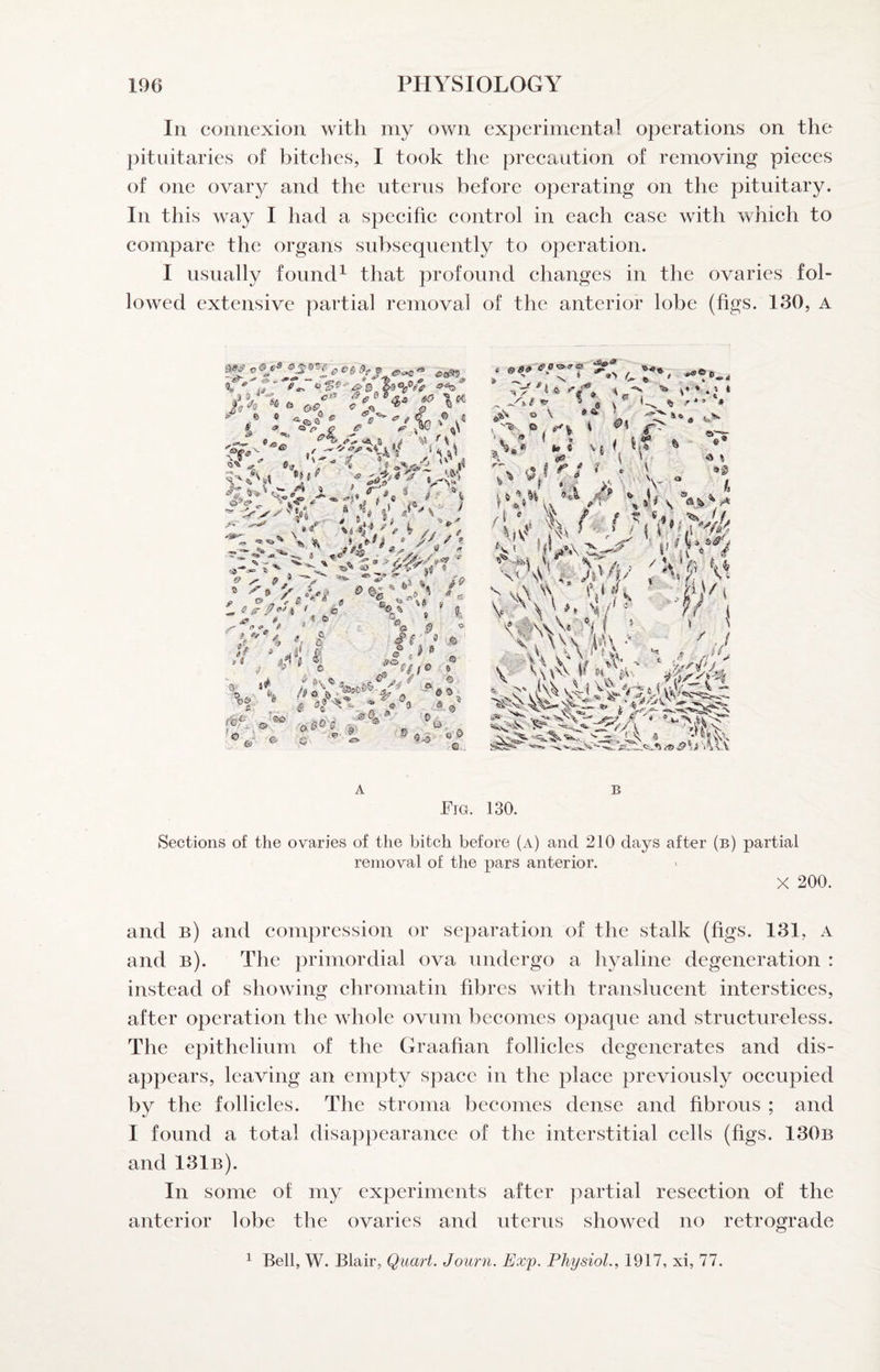 In connexion with my own experimental operations on the pitiiitaries of bitehes, I took the precaution of removing pieces of one ovar}^ and the uterus before operating on the pituitary. In this way I had a specifie control in each case with which to compare the organs subsequently to operation. I usually found^ that profound ehanges in the ovaries fol¬ lowed extensive partial removal of the anterior lobe (figs. 130, A fc‘ & 4 ^ ^^9 & 0 / * ■ i inr^- f r, t i Jl 1^ ^ e f*' ^ 4 A ^ ^ ' i & I . V >'**■'». 5 ■ . ^ 5>/ ^ ^ t? _ “V # « 0 4^ ^ ^ & ” ^ 1^ f *» .6 A B Fig. 130. Sections of the ovaries of the bitch before (a) and 210 days after (b) partial removal of the pars anterior. X 200. and b) and eompression or separation of the stalk (figs. 131, a and b). The primordial ova undergo a hyaline degeneration : instead of showing eliromatin fibres with translucent interstices, after operation the whole ovum becomes opaque and structureless. The epithelium of the Graafian follicles degenerates and dis¬ appears, leaving an empty space in the place previously occupied by the follieles. The stroma becomes dense and fibrous ; and I found a total disappearanee of the interstitial cells (figs. 130b and 131b). In some of my experiments after partial resection of the anterior lobe the ovaries and uterus showed no retrograde ^ Bell, W. Blair, Quart. Journ. Exp. Physiol., 1917, xi, 77.