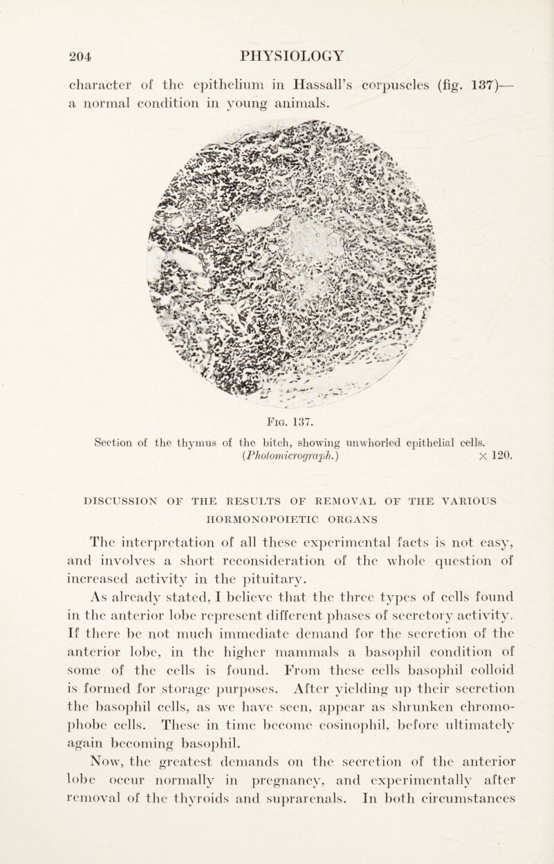 character of the epithelium in Hassall’s corpuscles (fig. 137)— a normal condition in young animals. Fig. 137. Section of the thymus of the bitch, showing unwhorled epithelial cells. {Phoiomicrograxjh.) X 120. DISCUSSION OF THE RESULTS OF REMOVAL OF THE VARIOUS HORMONOPOIETIC ORGANS The interpretation of all these experimental faets is not easy, and involves a short reeonsideration of the whole question of inereased aetivity in the pituitary. As already stated, I believe that the three types of eells found in the anterior lobe represent different phases of seeretory^ aetivity. If there be not mueh immediate demand for the secretion of the anterior lobe, in the higher mammals a basophil eondition of some of the eells is found. From these cells basophil eolloid is formed for storage purposes. After yielding up their seeretion the basophil eells, as we have seen, appear as shrunken ehrorno- phobe cells. These in time beeome eosinojihil, before ultimately again becoming basophil. Now, the greatest demands on the seeretion of the anterior lobe oeeur normally in pregnaney, and experimentally after removal of the thyroids and suprarenals. In both eireumstanees