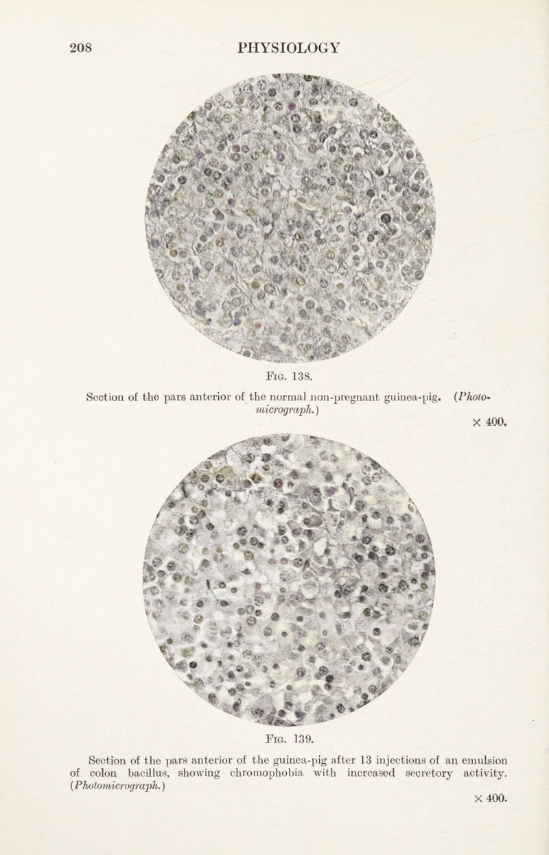 Fig. 138. Section of the pars anterior of the normal non-pregnant guinea-pig, microgra'pli.) (Phoio^ X 400. Section of the pars anterior of the guinea-pig after 13 injections of an emulsion of colon bacillus, showing chromophobia with increased secretory activity. {Photomicrograph.) X 400.