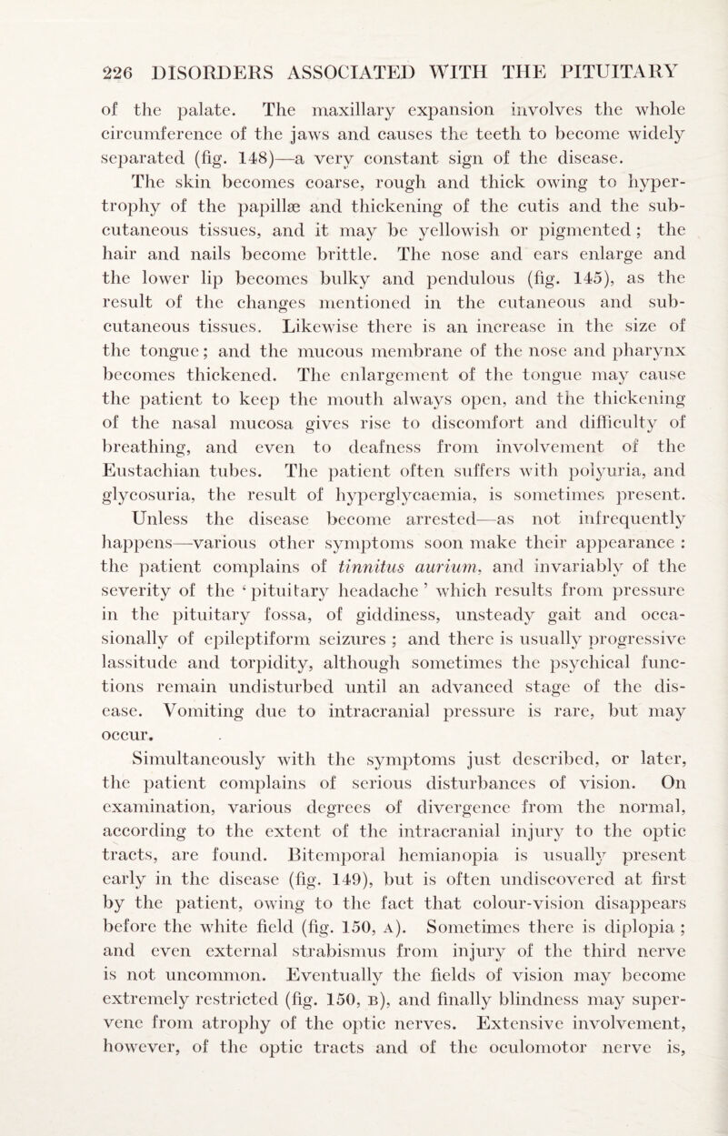 of the palate. The maxillary expansion involves the whole circumference of the jaws and causes the teeth to become widely separated (fig. 148)—a very constant sign of the disease. The skin becomes coarse, rough and thick owing to hyper¬ trophy of the papillae and thickening of the cutis and the sub¬ cutaneous tissues, and it may be yellowish or pigmented ; the hair and nails become brittle. The nose and ears enlarge and the lower lip becomes bulky and pendulous (fig. 145), as the result of the changes mentioned in the cutaneous and sub¬ cutaneous tissues. Likewise there is an increase in the size of the tongue; and the mucous membrane of the nose and pharynx becomes thickened. The enlargement of the tongue may cause the patient to keep the mouth always open, and the thickening of the nasal mucosa gives rise to discomfort and difficulty of breathing, and even to deafness from involvement of the Eustachian tubes. The patient often suffers with polyuria, and glycosuria, the result of hyperglycaemia, is sometimes present. Unless the disease become arrested—as not infrequently happens—various other symptoms soon make their appearance : the patient complains of tinnitus aurium. and invariably of the severity of the ‘pituitary headache’ which results from pressure in the pituitary fossa, of giddiness, unsteady gait and occa¬ sionally of epileptiform seizures ; and there is usually progressive lassitude and torpidity, although sometimes the psychical func¬ tions remain undisturbed until an advanced stage of the dis¬ ease. Vomiting due to intracranial pressure is rare, but may occur. Simultaneously with the symptoms just described, or later, the patient complains of serious disturbances of vision. On examination, various degrees of divergence from the normal, according to the extent of the intracranial injury to the optic tracts, are found. Bitemporal hemianopia is usually present early in the disease (fig. 149), but is often undiscovered at first by the patient, owing to the fact that colour-vision disappears before the white field (fig. 150, a). Sometimes there is diplopia ; and even external strabismus from injury of the third nerve is not uncommon. Eventually the fields of vision ma}' become extremely restricted (fig. 150, b), and finally blindness may super¬ vene from atrophy of the optic nerves. Extensive involvement, however, of the optic tracts and of the oculomotor nerve is,