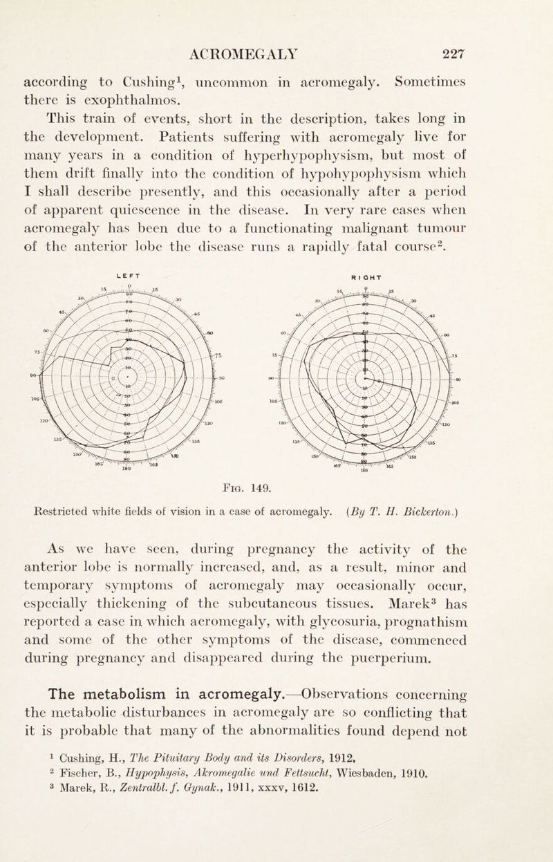 according to Cushing^, uncommon in acromegaly. Sometimes there is exophthalmos. This train of events, short in the description, takes long in the development. Patients suffering with acromegaly live for many years in a eondition of hyperhypophysism, but most of them drift finally into the eondition of hypohypophysism whieh I shall deseribe presently, and this oeeasionally after a period of apparent qnieseenee in the disease. In very rare eases when acromegaly has been due to a functionating malignant tumour of the anterior lobe the disease runs a rapidly fatal course^. RIGHT Fig. 149. Restricted white fields of vision in a case of acromegaly. {By T. H, Bickerton,) As we have seen, during pregnancy the activity of the anterior lobe is normally increased, and, as a result, minor and temporary symptoms of acromegaly may occasionally occur, especially thickening of the subcutaneous tissues. Marek^ has reported a case in which acromegaly, with glycosuria, prognathism and some of the other symptoms of the disease, commenced during pregnancy and disappeared during the puerperium. The metabolism in acromegaly.—Observations concerning the metabolic disturbances in acromegaly are so conflicting that it is probable that many of the abnormalities found depend not 1 Cushing, H., The Pituitary Body and its Disorders^ 1912. 2 Fischer, B., Hypophysis, Akromegalie und Fettsucht, Wiesbaden, 1910. ^ Marek, R., Zentralhl. Oynak., 1911, xxxv, 1612.
