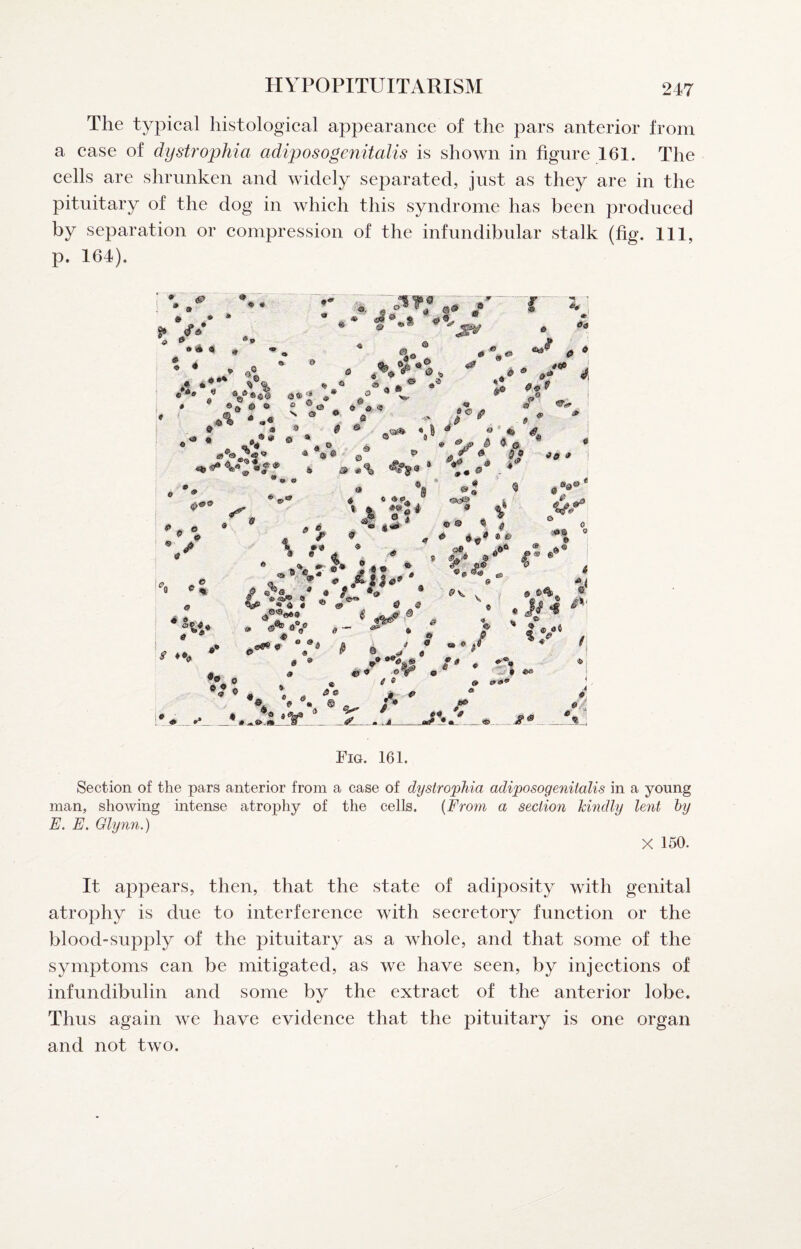 HYPOPITUITARISM The typical histological appearance of the pars anterior from a case of dystrophia adiposogenitalis is shown in figure 161. The cells are shrunken and widely separated, just as they are in the pituitary of the dog in which this syndrome has been produced by separation or compression of the infundibular stalk (fig. Ill, p. 164). • * - O'- •'a * ^ ' of ® . * r # a 6 • A ' i *4* 0 j • # ® O ^ r * *• 4» >•> S 0 • 9®# ® * 9 ® • J ^ «*# C * ^  * sT ^ IJ # j 9, 0 »• ® « « *«% . af 0 4 ^ * o ® ''9 / ® • ® 9 a* O ««.« J? I i-®* ®«s # f fl»0® 8 # Of ^0 * <s o » ® <» ♦ •a iS> # _ • <**> a « d « » aV « 0 0* V I / ' I M a 40 9 ■€ a * « ^ e ® A ^ ♦ “a ® ^ / _s_ •*0 i _ .4 Fig. 161. Section of the pars anterior from a case of dystrophia adiposogenitalis in a young man, showing intense atrophy of the cells. {From a section hindly lent hy E, E. Glynn.) X 150. It appears, then, that the state of adiposity with genital atrophy is due to interference with secretory function or the blood-supply of the pituitary as a wRole, and that some of the symptoms can be mitigated, as we have seen, by injections of infundibulin and some by the extract of the anterior lobe. Thus again we have evidence that the pituitary is one organ and not two.