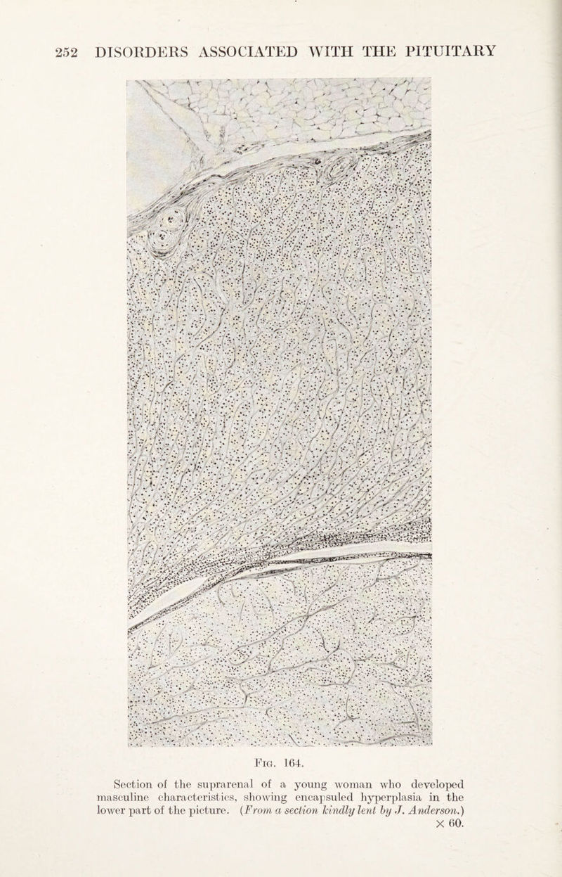 Fig. 164. Section of the suprarenal of a young woman Avho developed masculine characteristics, showing encapsuled hyperplasia in the lower part of the picture. {From, a section kindly lent by J. Anderson.) X 60.