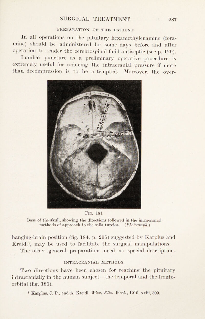 PREPARATION OF THE PATIENT In all operations on the pituitary hexamethylenamine (fora- mine) should be administered for some days before and after operation to render the eerebrospinal fluid antiseptic (see p. 129). Lumbar puneture as a preliminary operative proeedure is extremely useful for reducing the intracranial pressure if more than deeompression is to be attempted. Moreover, the over- Fig. 181. Base of the skull, showing the directions followed in the intracranial methods of approach to the sella turcica. {Photograph.) hanging-brain position (fig. 184, p. 295) suggested by Karplus and KreidU, may be used to faeilitate the surgieal manipulations. The other general preparations need no special description. INTRACRANIAL METHODS Two directions have been chosen for reaehing the pituitary intracranially in the human subject—the temporal and the fronto- orbital (fig. 181). ^ Karplus, J. P., and A. Kreidl, Wien, Klin. Woch., 1910, xxiii, 309.